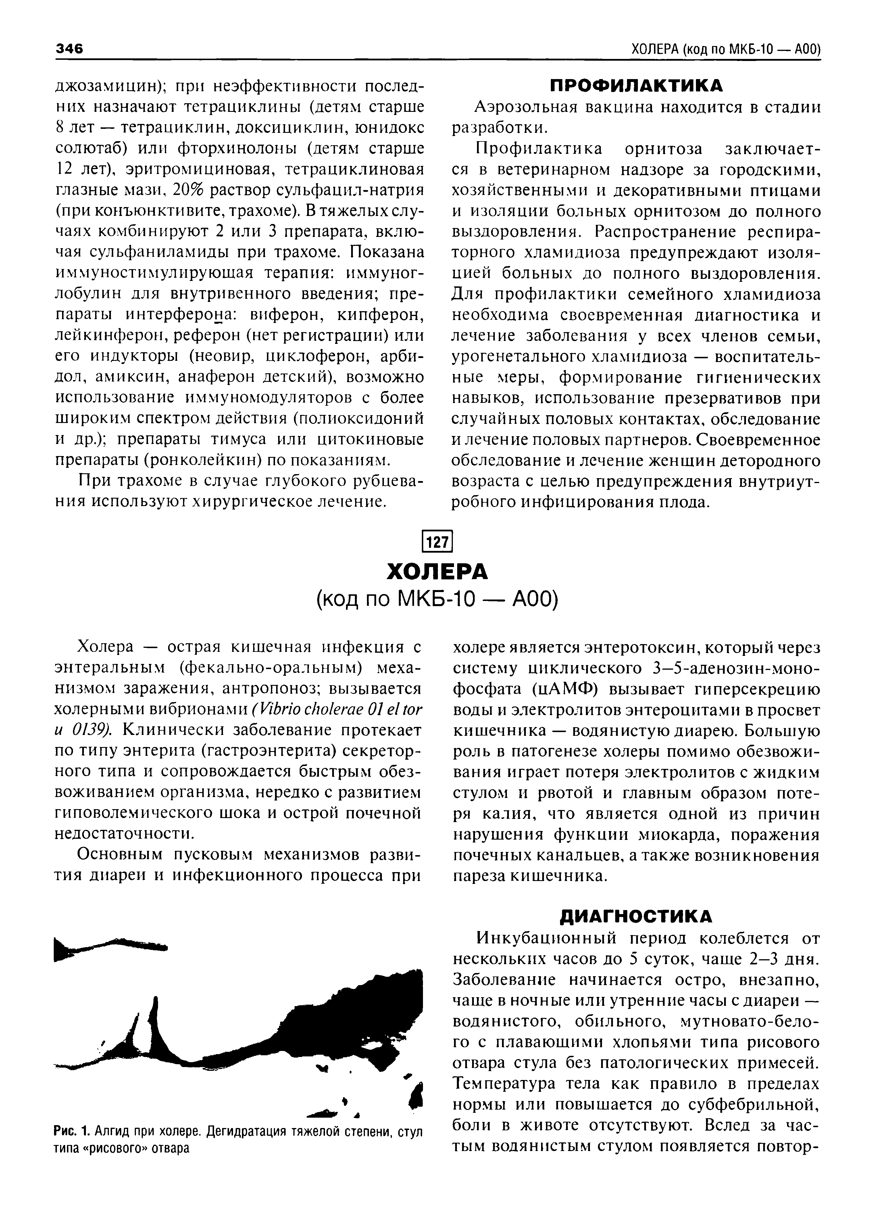 Рис. 1. Алгид при холере. Дегидратация тяжелой степени, стул типа рисового отвара...