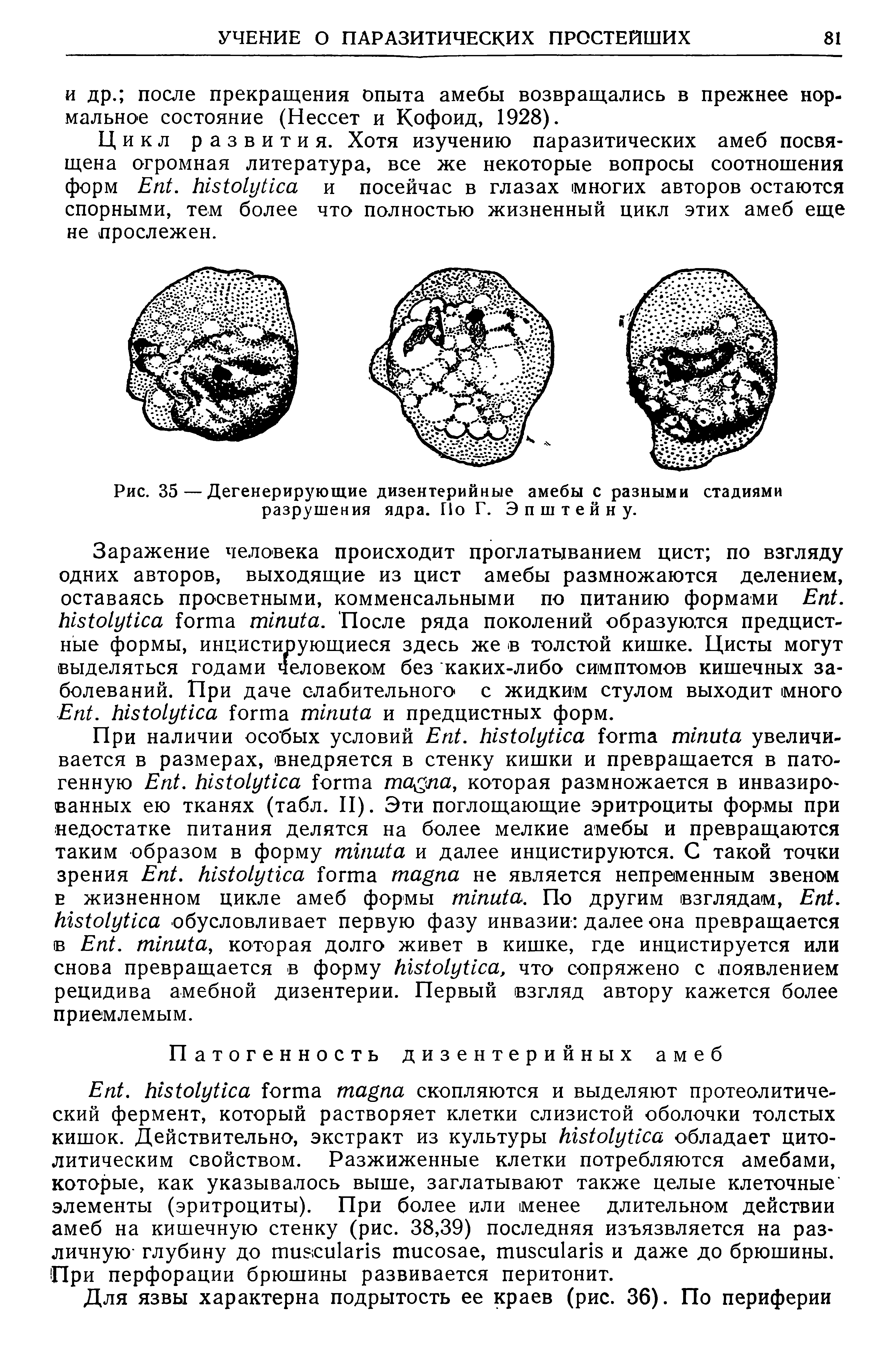 Рис. 35 — Дегенерирующие дизентерийные амебы с разными стадиями разрушения ядра. Но Г. Эпштейну.