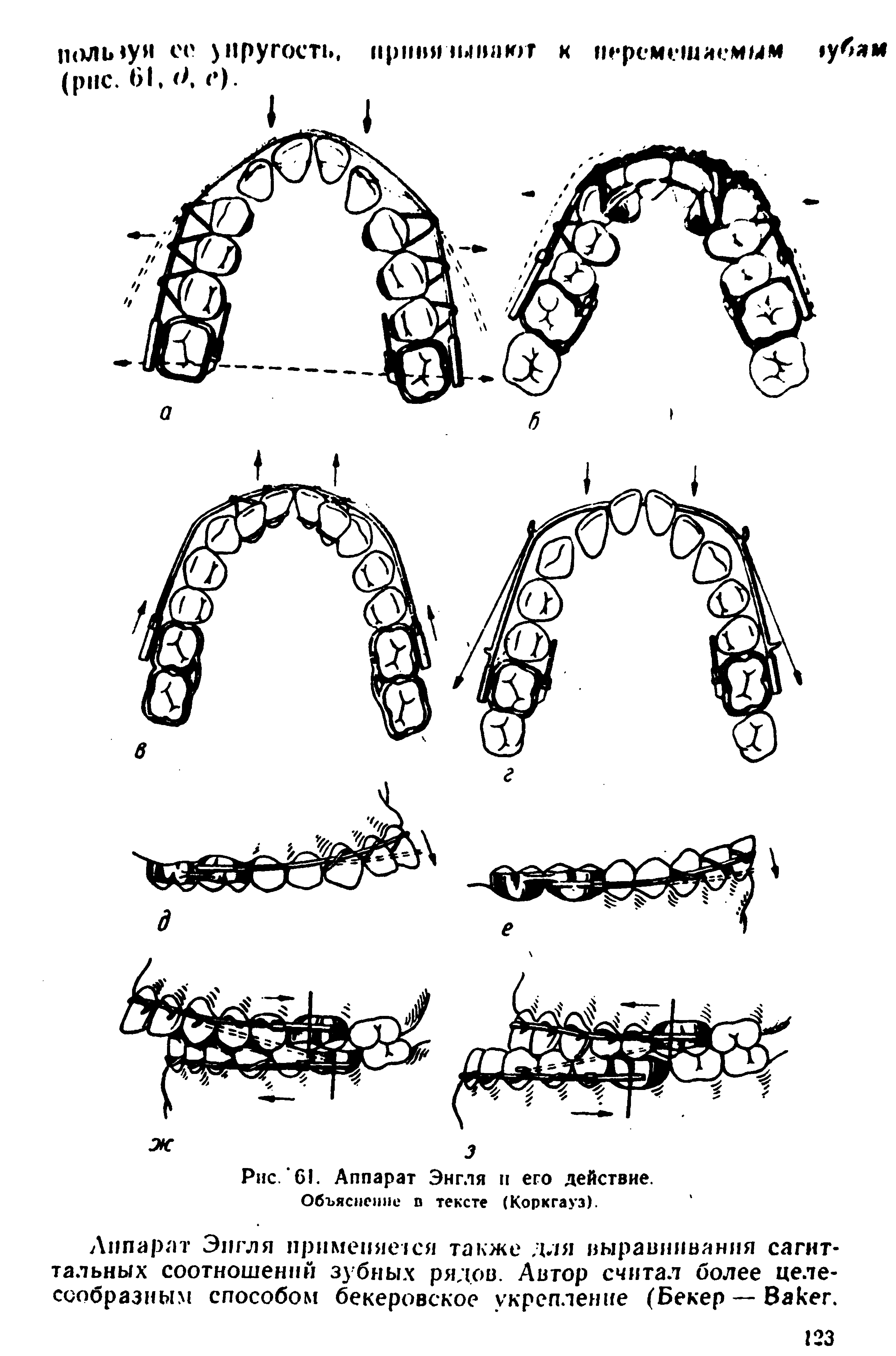 Рис. 61. Аппарат Энгля п его действие. Объяснение п тексте (Коркгауз).