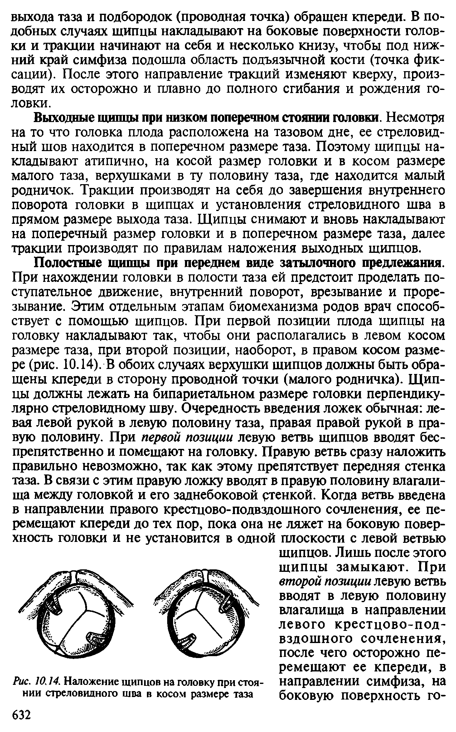 Рис. 10.14. Наложение щипцов на головку при стоянии стреловидного шва в косом размере таза...