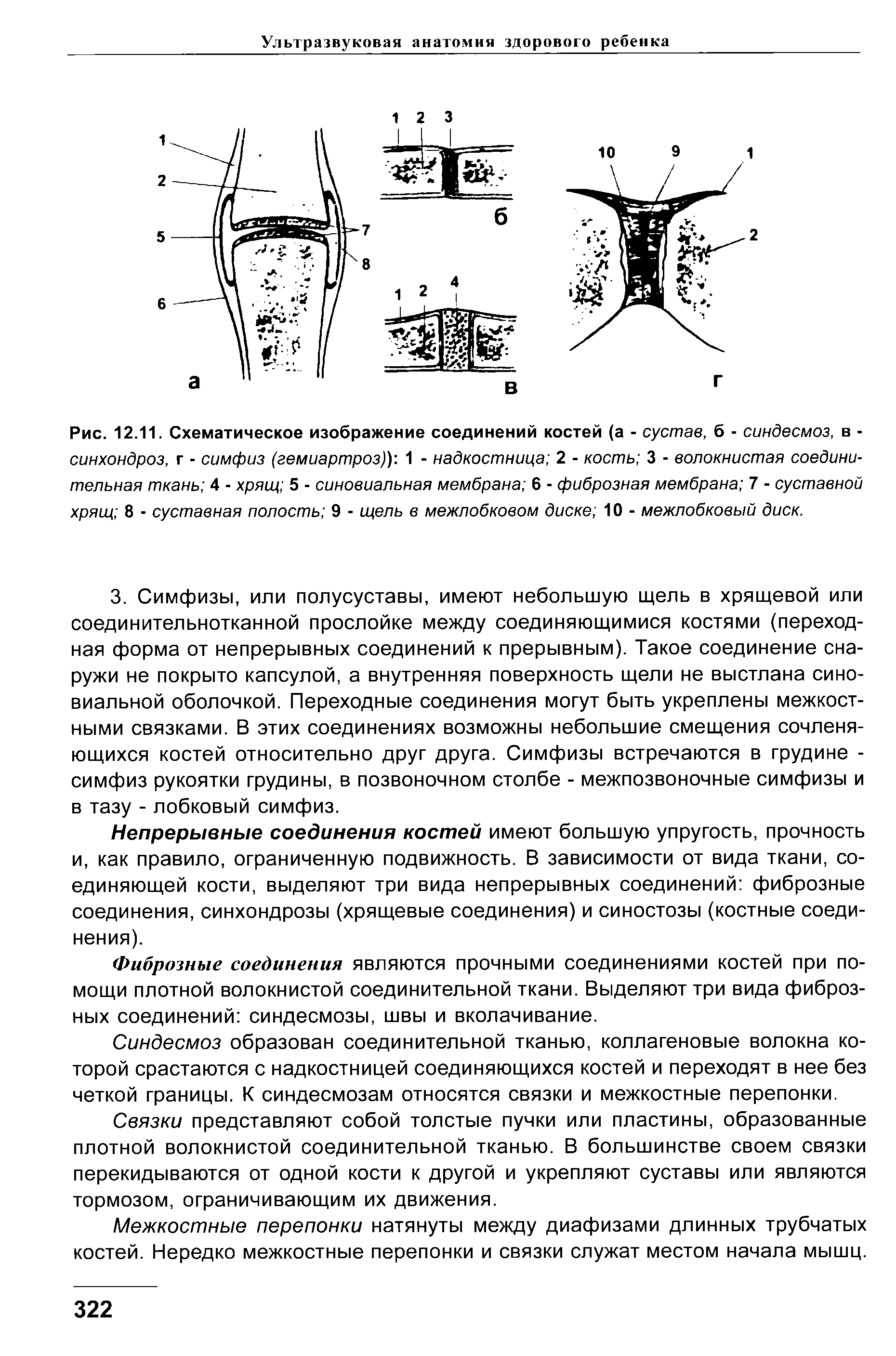 Рис. 12.11. Схематическое изображение соединений костей (а - сустав, б - синдесмоз, в -синхондроз, г - симфиз (гемиартроз)) 1 - надкостница 2 - кость 3 - волокнистая соединительная ткань 4 - хрящ 5 - синовиальная мембрана 6 - фиброзная мембрана 7 - суставной хрящ 8 - суставная полость 9 - щель в межлобковом диске 10 - межлобковый диск.