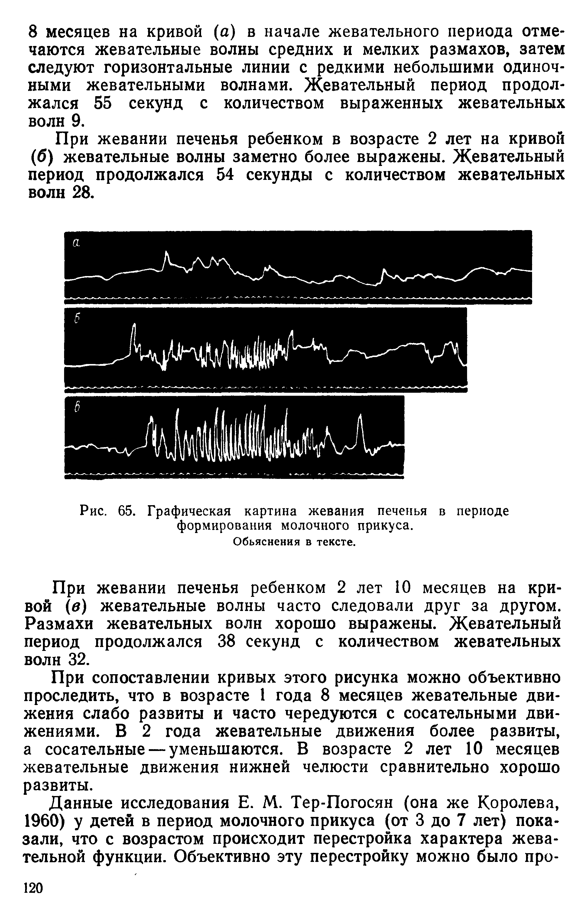 Рис. 65. Графическая картина жевания печенья в периоде формирования молочного прикуса.