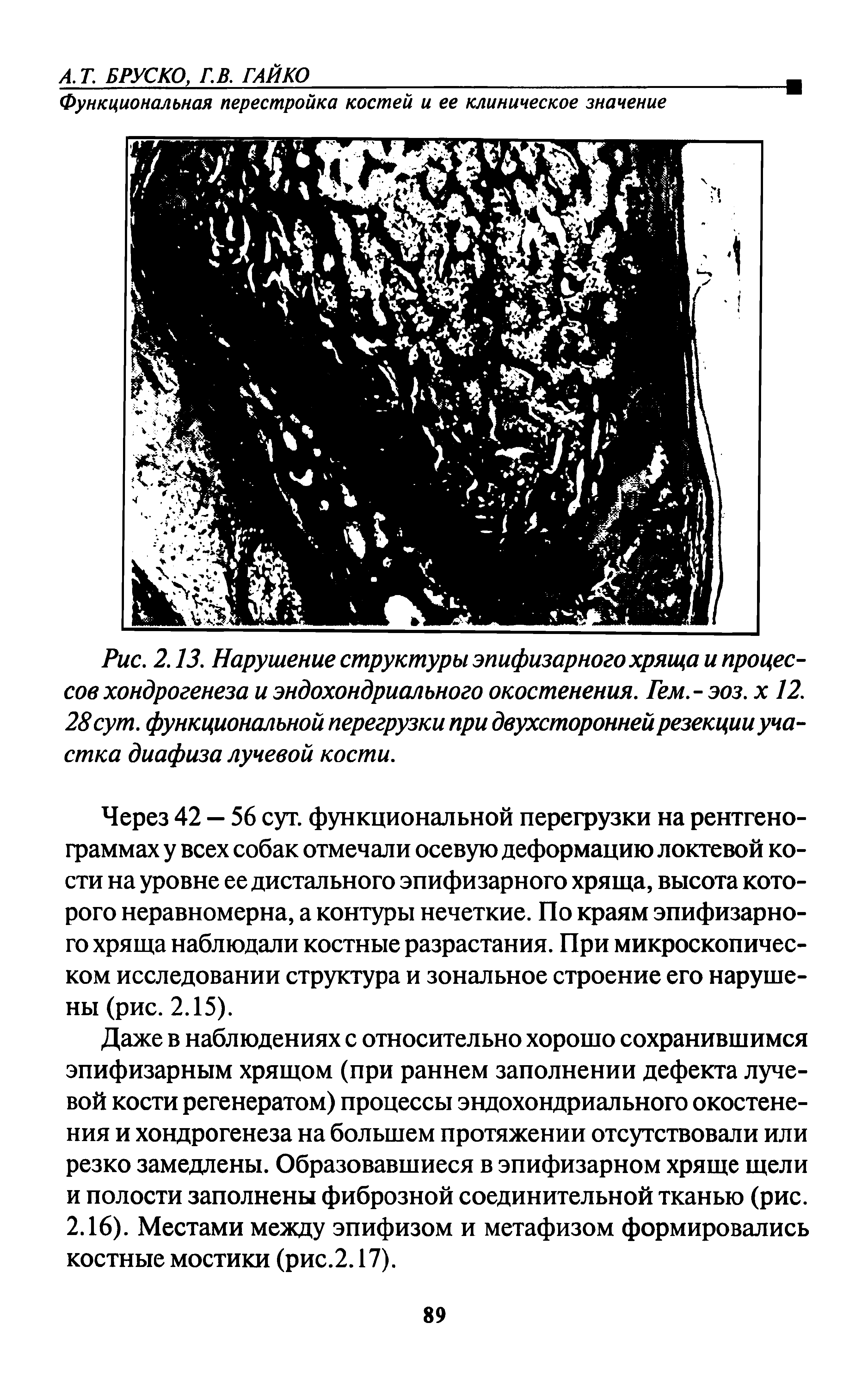 Рис. 2.13. Нарушение структуры эпифизарного хряща и процессов хондрогенеза и эндохондриалъного окостенения. Гем.- эоз. х 12. 28сут. функциональной перегрузки при двухсторонней резекции участка диафиза лучевой кости.