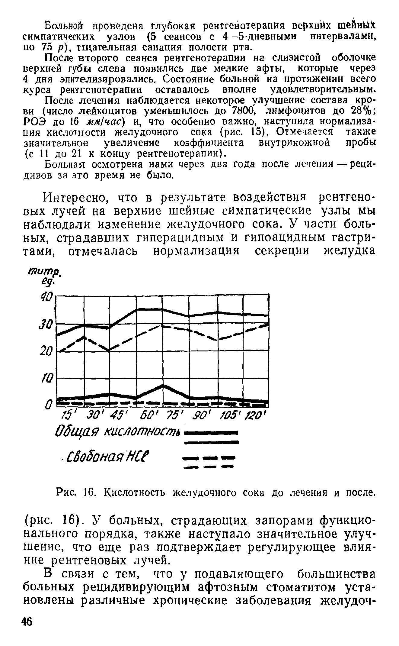 Рис. 16. Кислотность желудочного сока до лечения и после, (рис. 16). У больных, страдающих запорами функционального порядка, также наступало значительное улучшение, что еще раз подтверждает регулирующее влияние рентгеновых лучей.