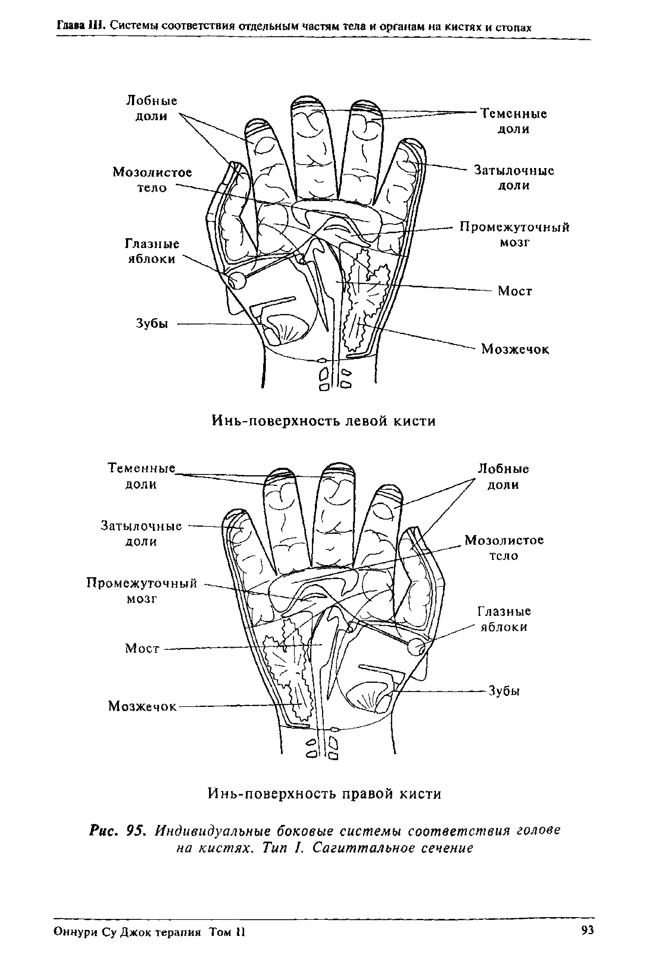 Рис. 95. Индивидуальные боковые системы соответствия голове на кистях. Тип /. Сагиттальное сечение...