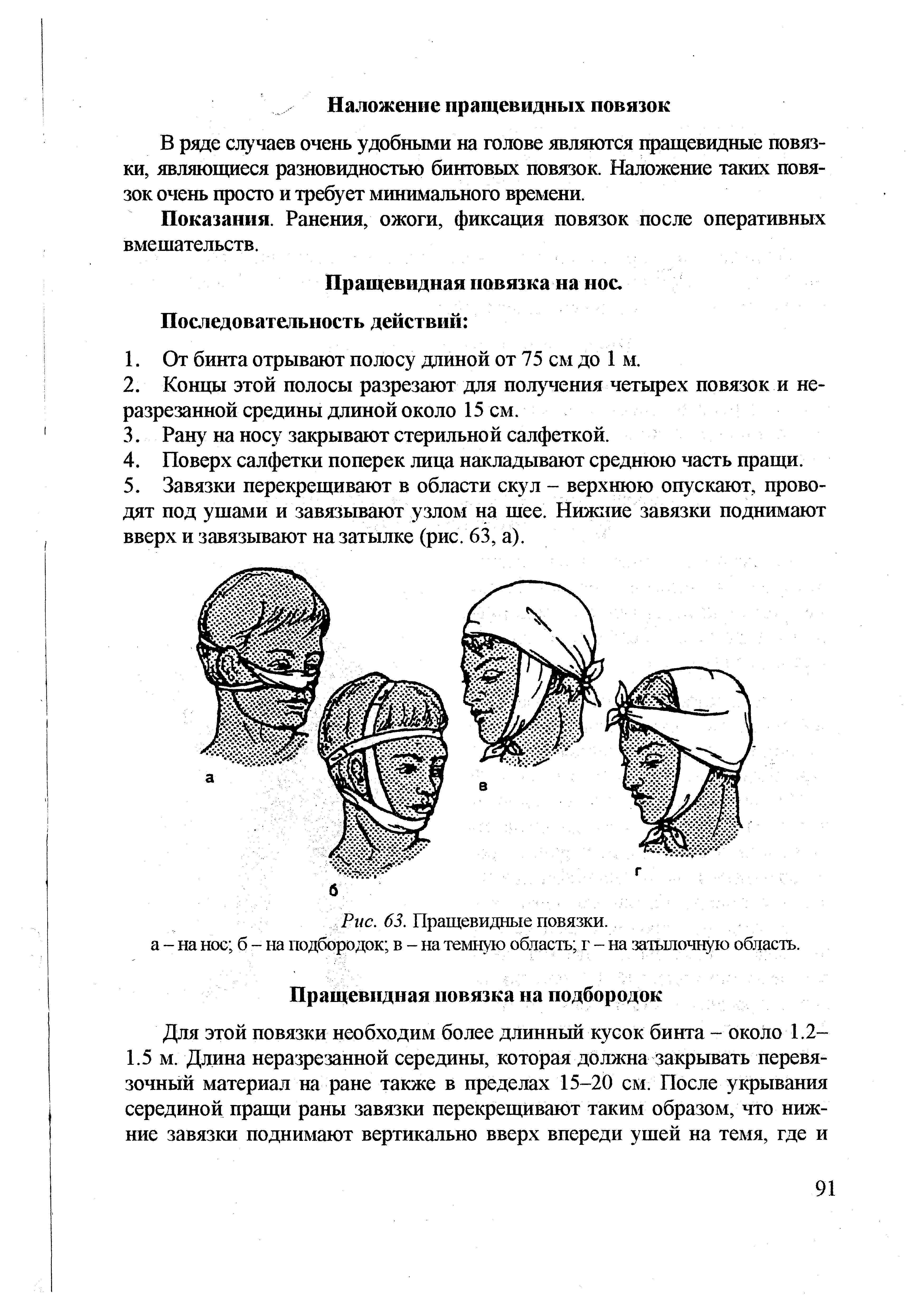 Рис. 63. Пращевидные повязки, а - на нос б - на подбородок в - на темную область г - на затылочную область.