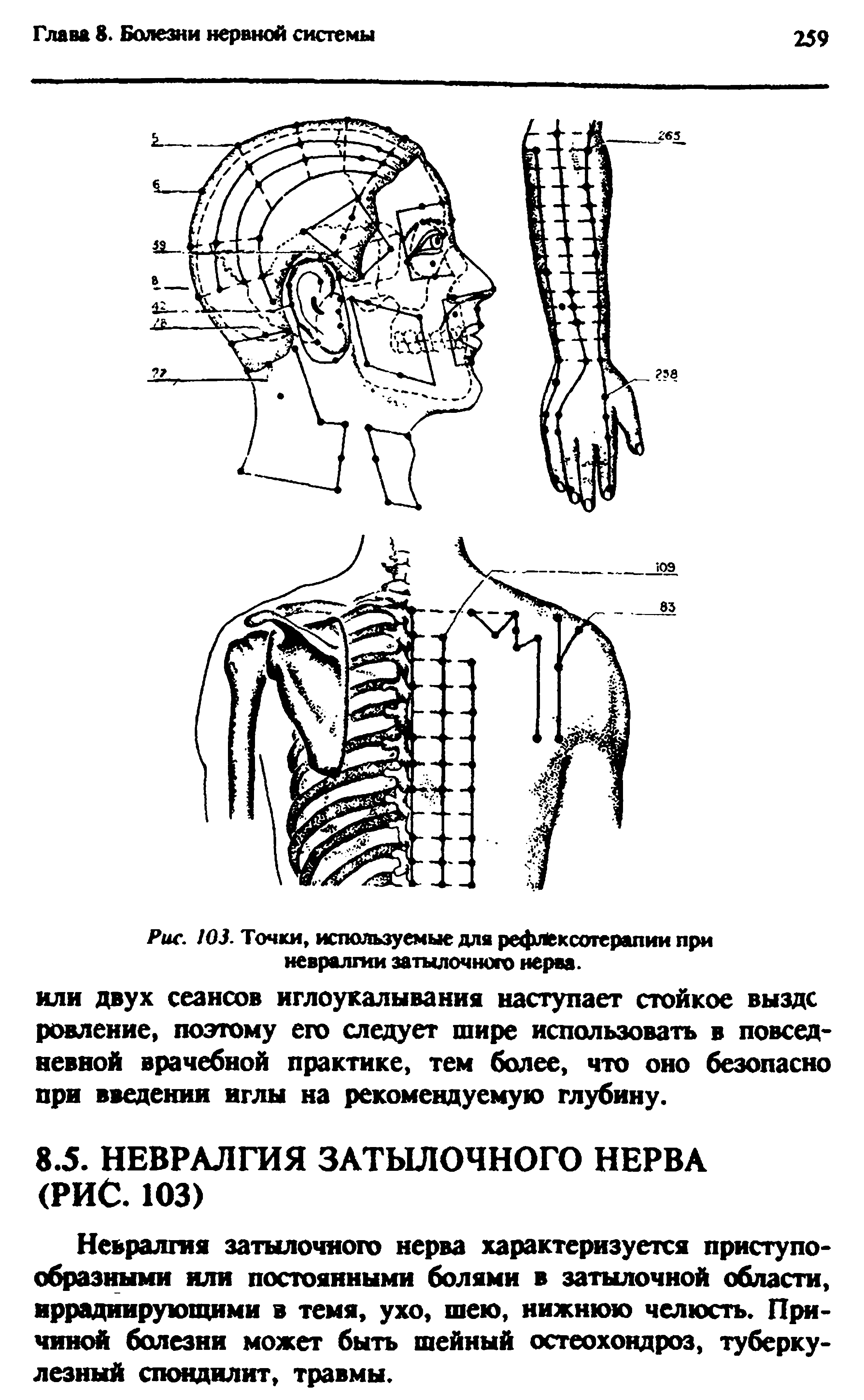 Рис. 103. Точки, используемые для рефлексотерапии при невралгии затылочного нерва.