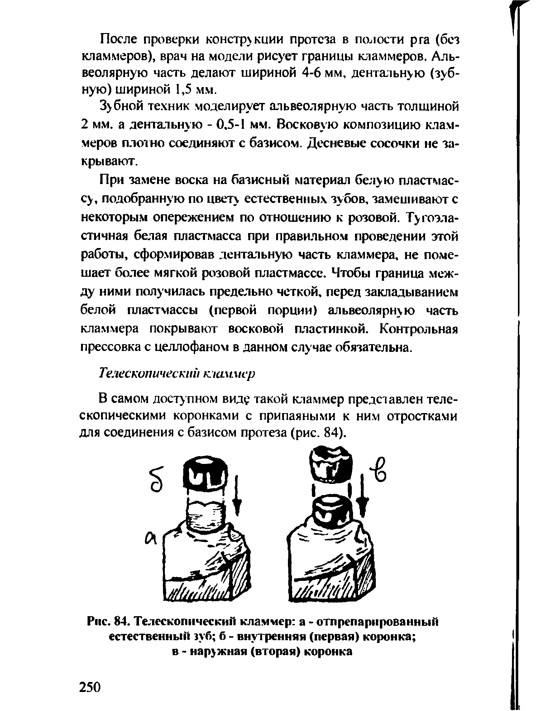 Рис. 84. Телескопический кламмер а - отпрепарированный естественный зуб б - внутренняя (первая) коронка в - наружная (вторая) коронка...