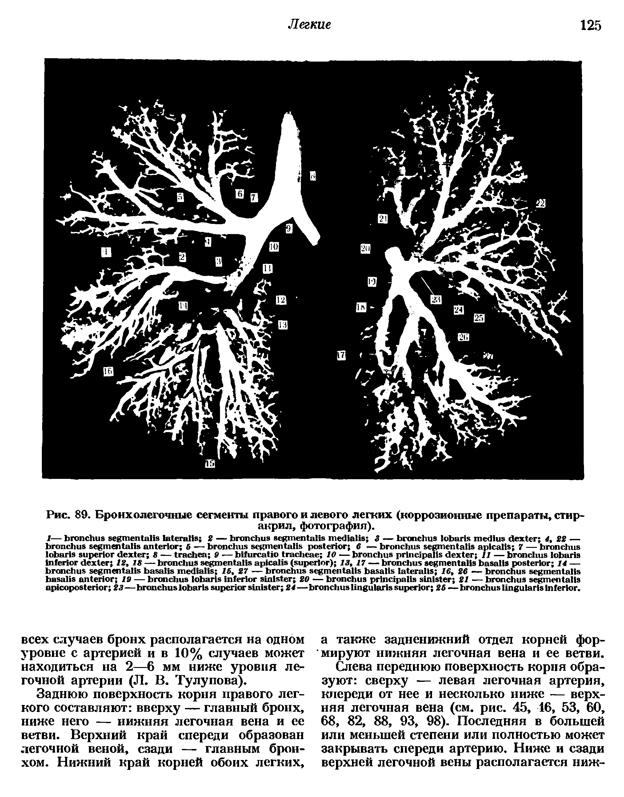 Рис. 89. Бронхолегочные сегменты правого и левого легких (коррозионные препараты, сгир-акрил, фотография).