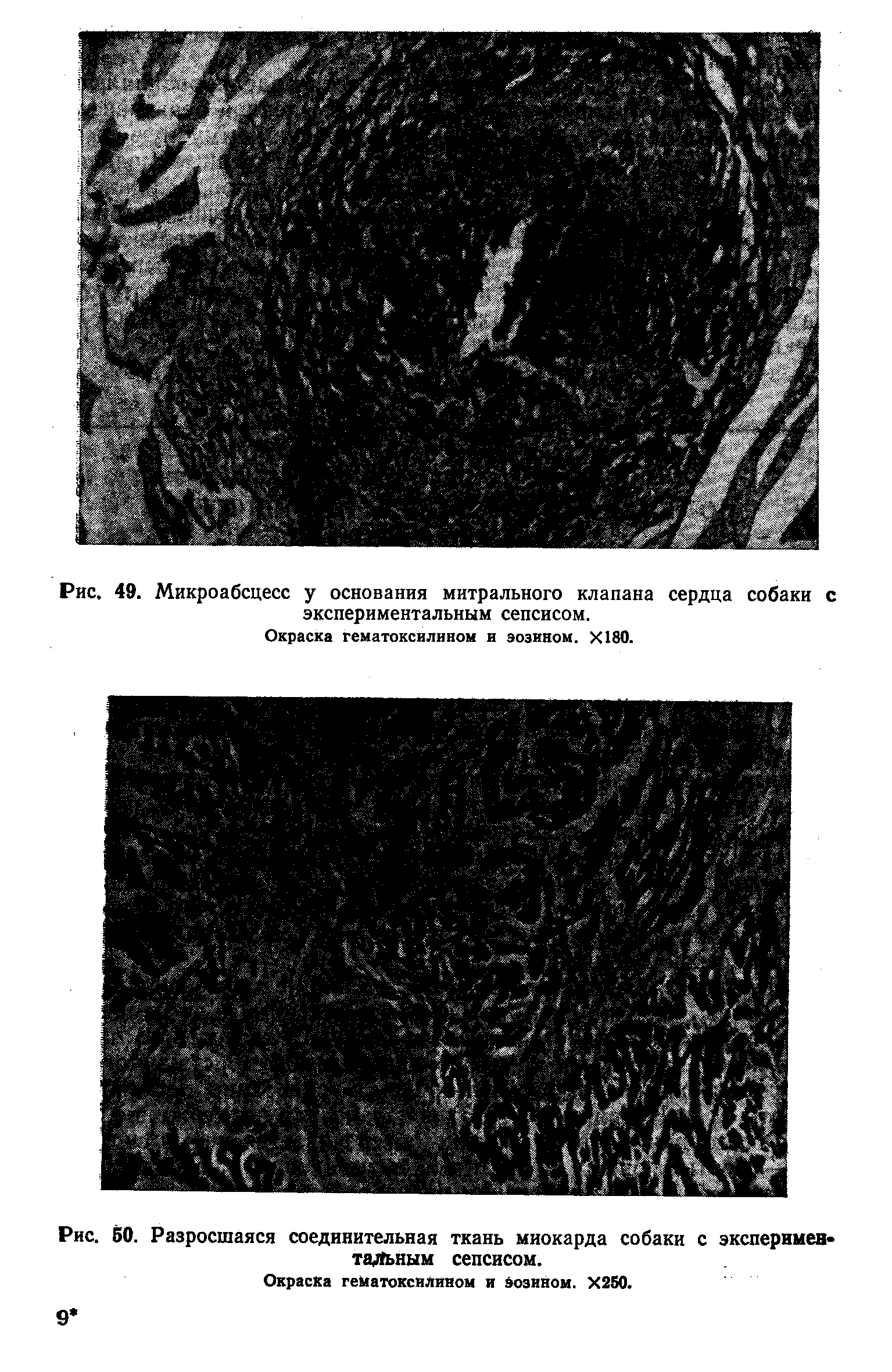 Рис. 50. Разросшаяся соединительная ткань миокарда собаки с экспериментальным сепсисом.