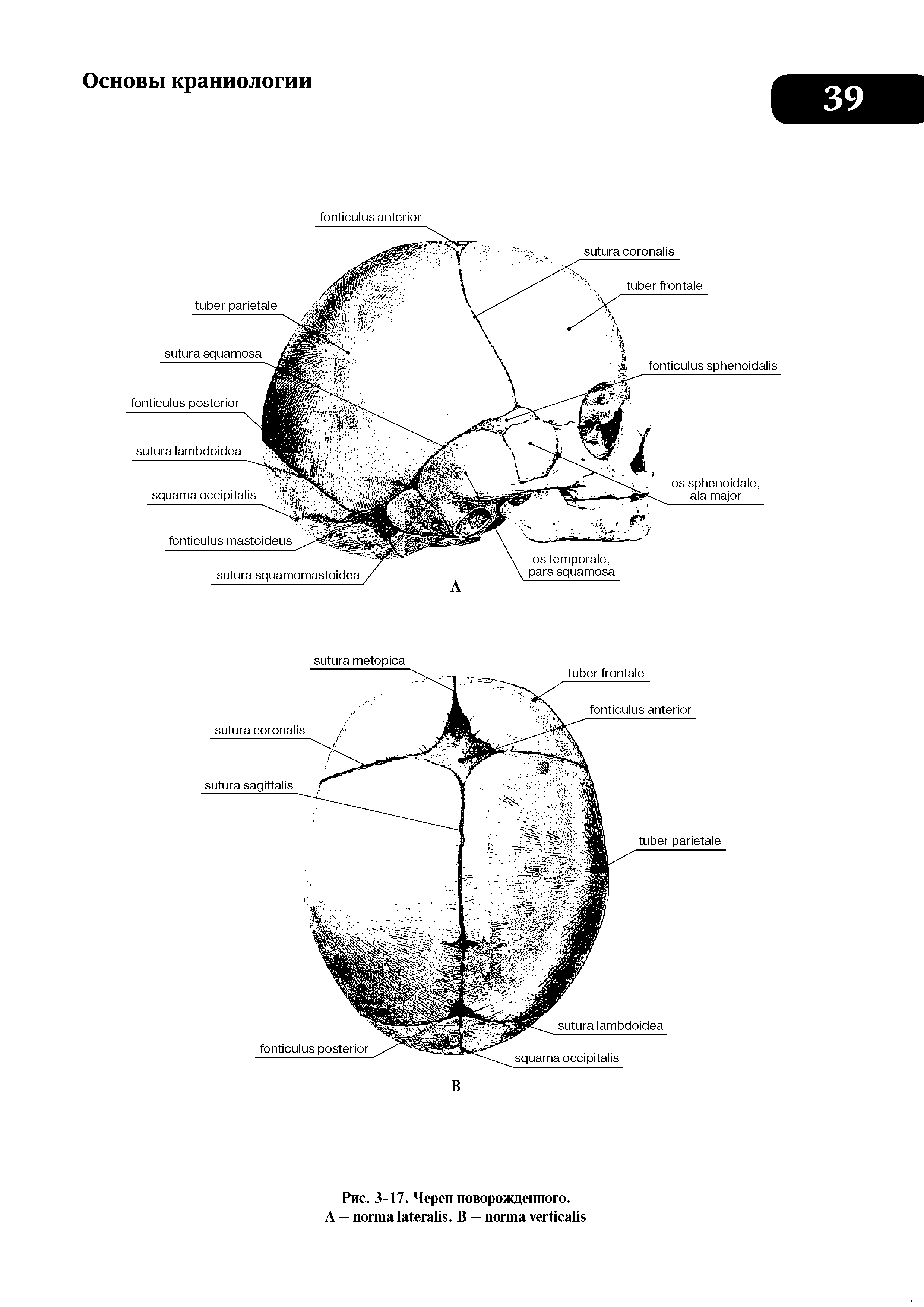 Рис. 3-17. Череп новорожденного. А — . В — ...