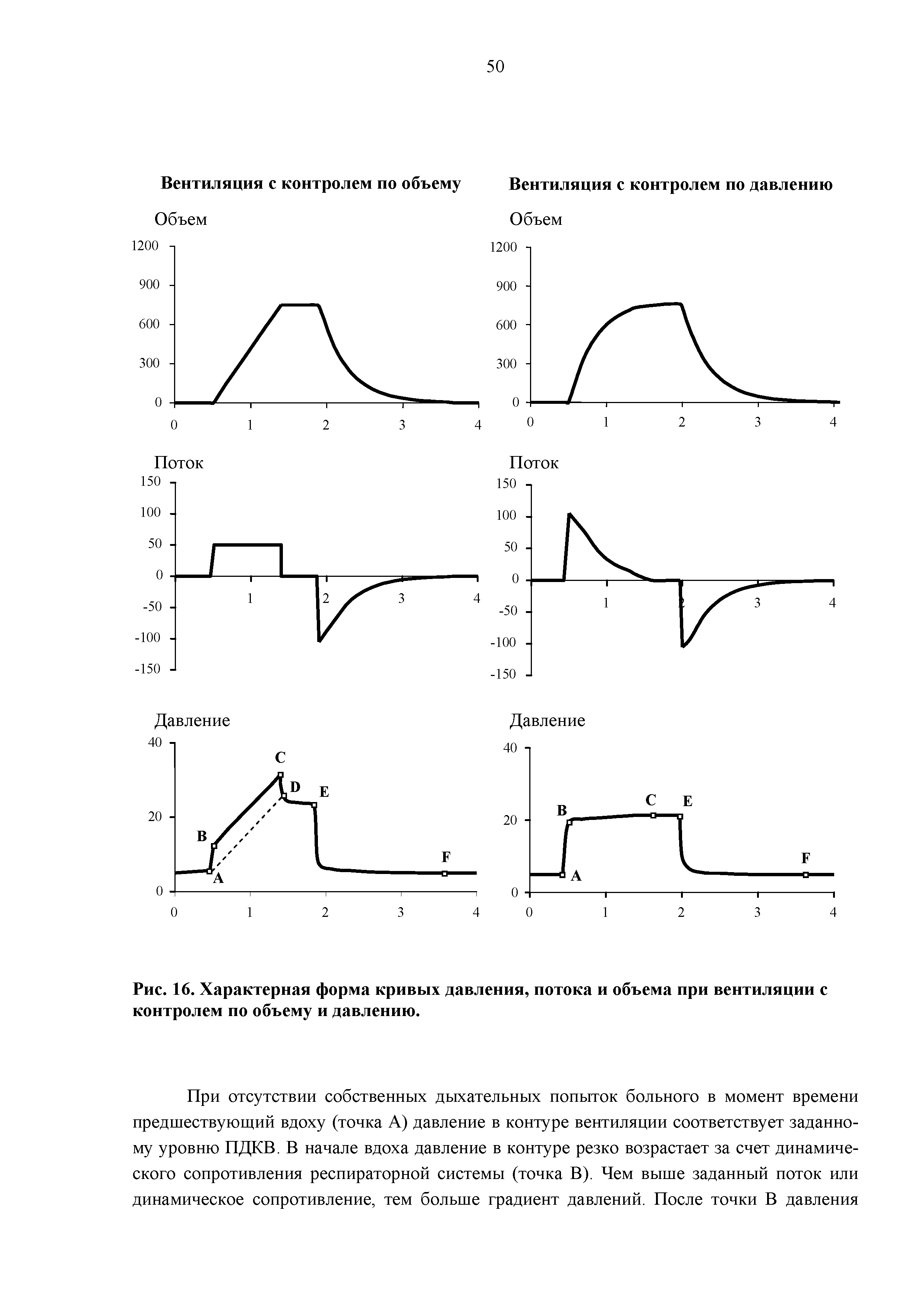 Рис. 16. Характерная форма кривых давления, потока и объема при вентиляции с контролем по объему и давлению.