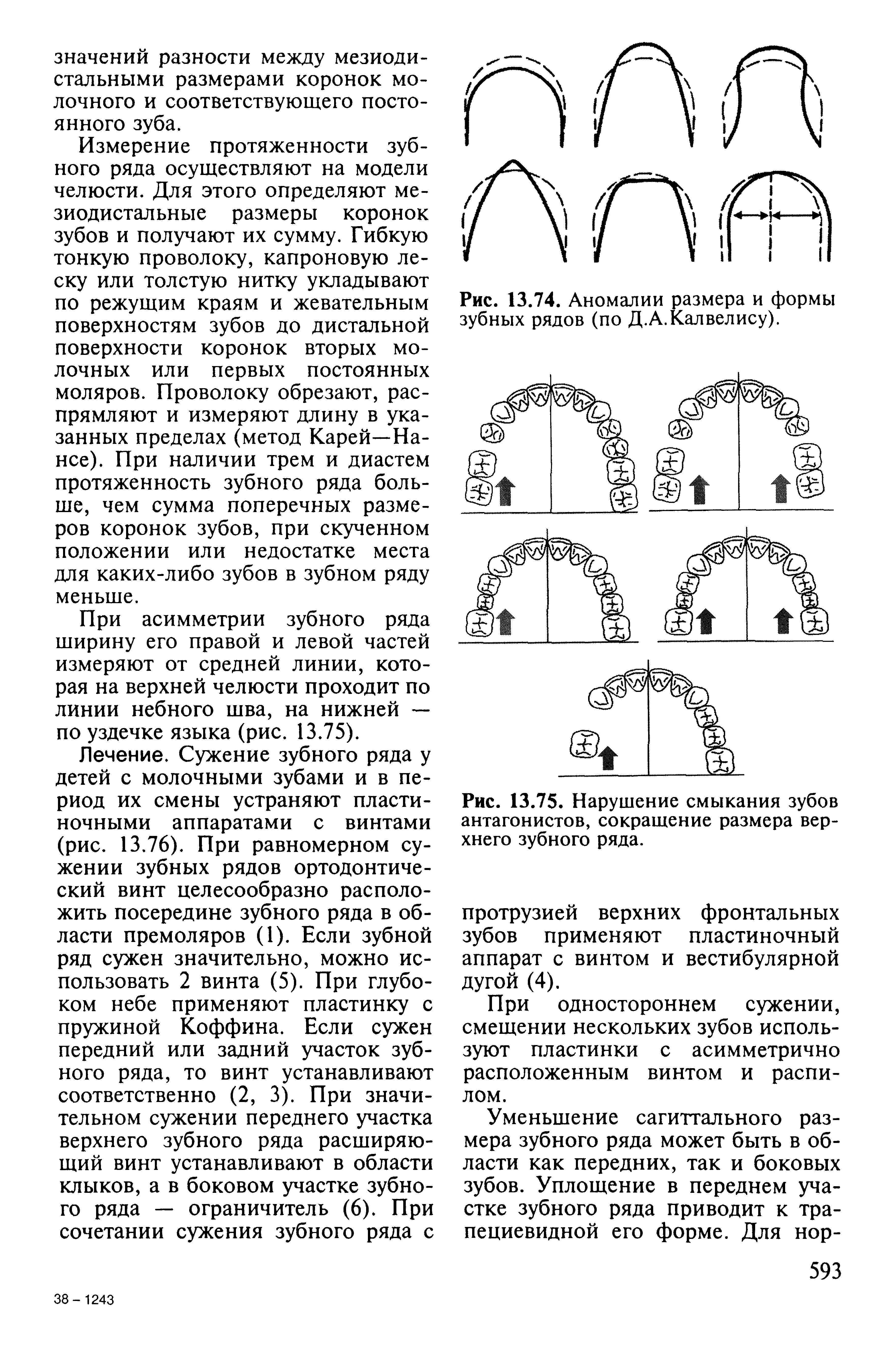 Рис. 13.74. Аномалии размера и формы зубных рядов (по Д.А.Калвелису).