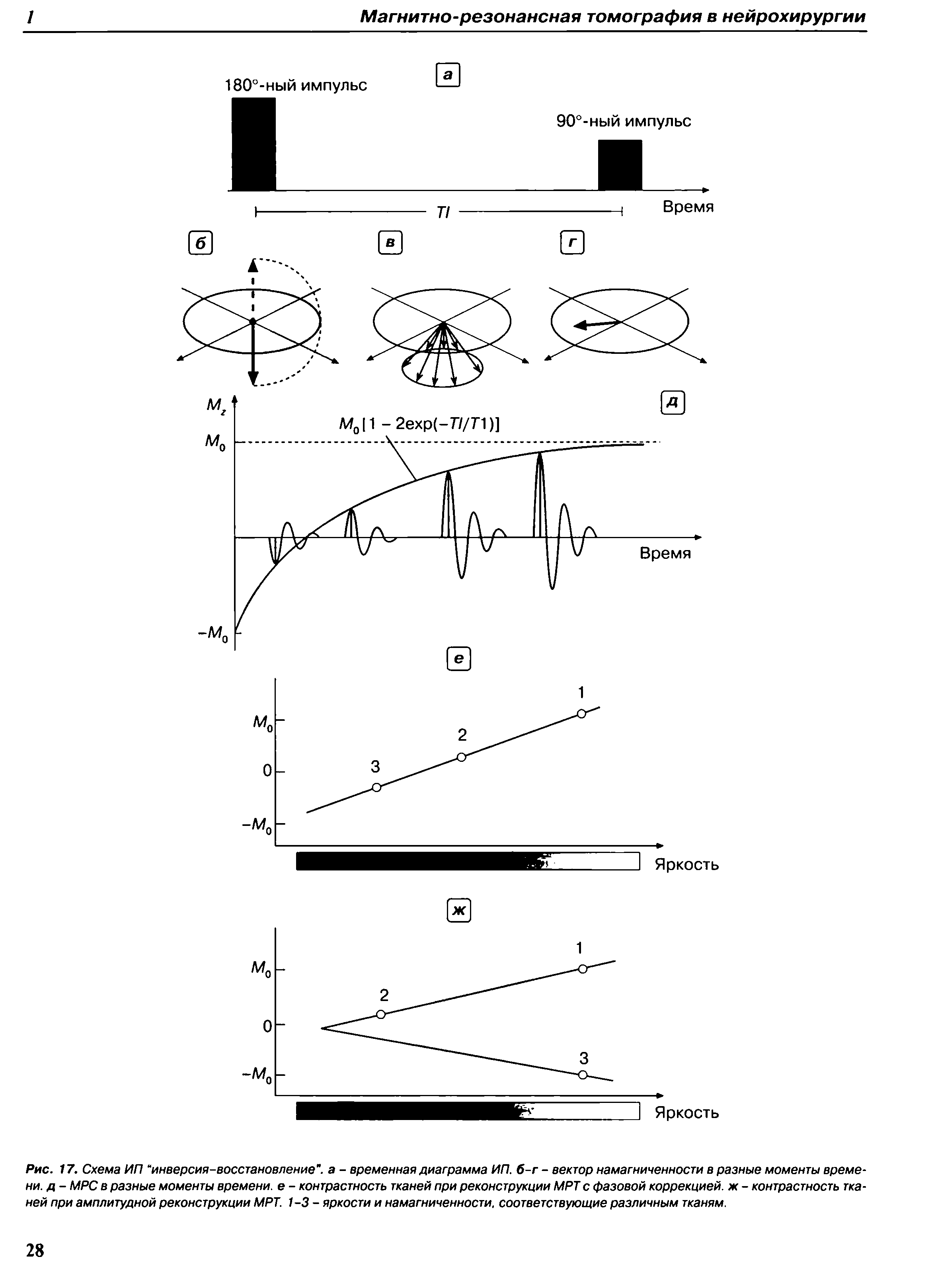 Рис. 17. Схема ИП инверсия-восстановление", а - временная диаграмма ИП. б-г - вектор намагниченности в разные моменты времени. д - MPC в разные моменты времени, е - контрастность тканей при реконструкции МРТ с фазовой коррекцией, ж - контрастность тканей при амплитудной реконструкции МРТ. 1-3- яркости и намагниченности, соответствующие различным тканям.