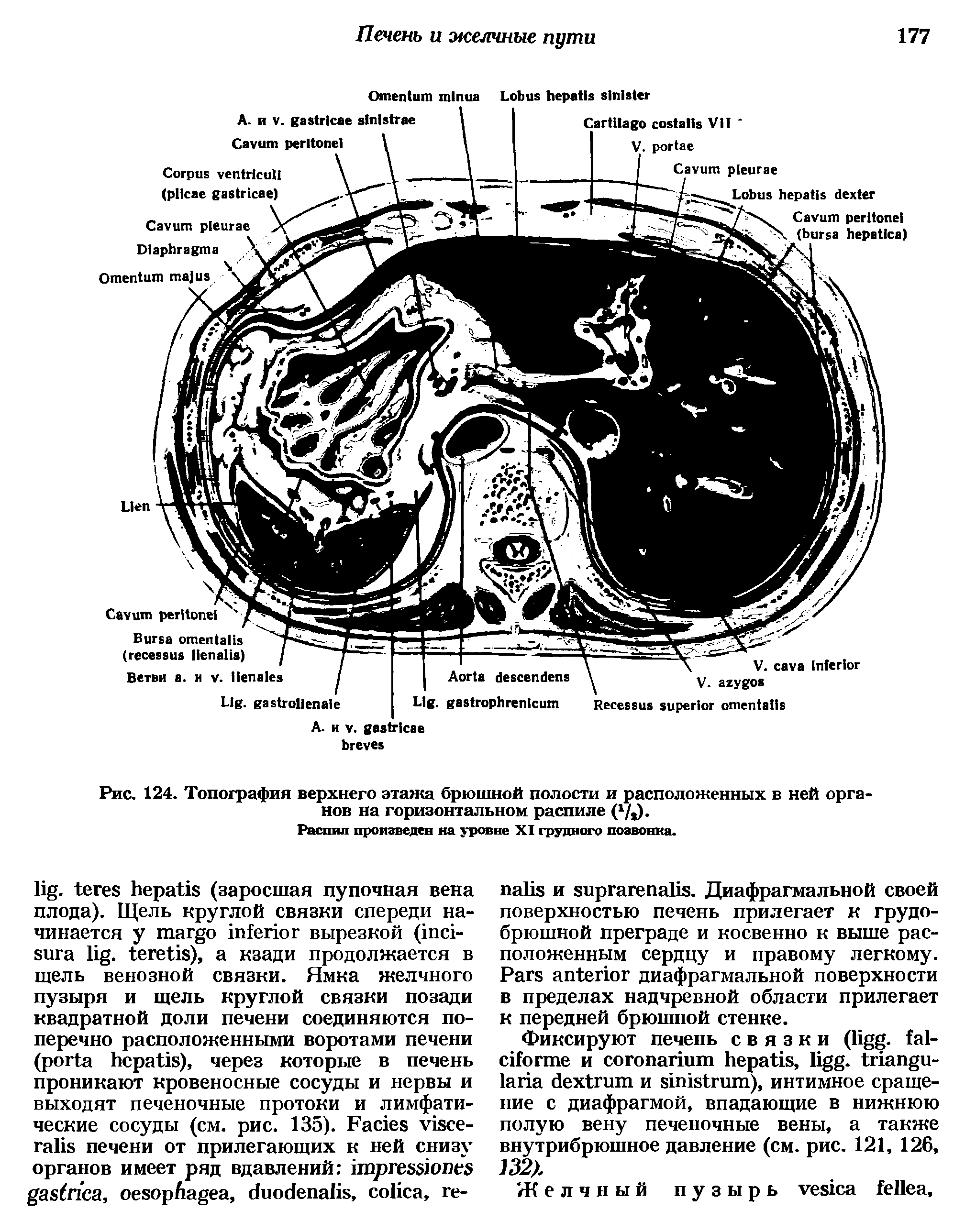 Рис. 124. Топография верхнего этажа брюшной полости и расположенных в ней органов на горизонтальном распиле ( 7,)-Распил произведен на уровне XI грудного позвонка.