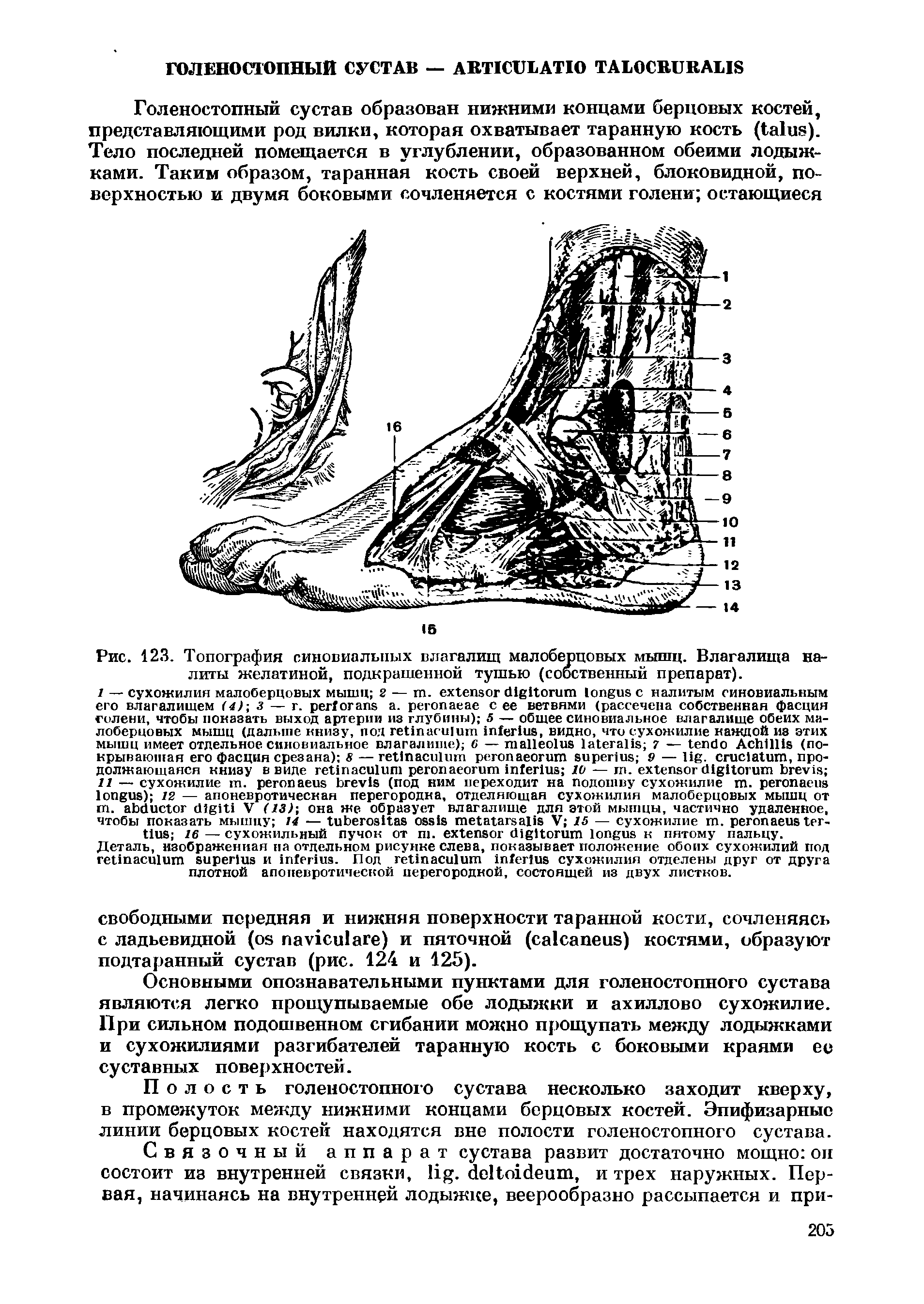 Рис. 123. Топография синовиальных влагалищ малоберцовых мышц. Влагалища налиты желатиной, подкрашенной тушью (собственный препарат).