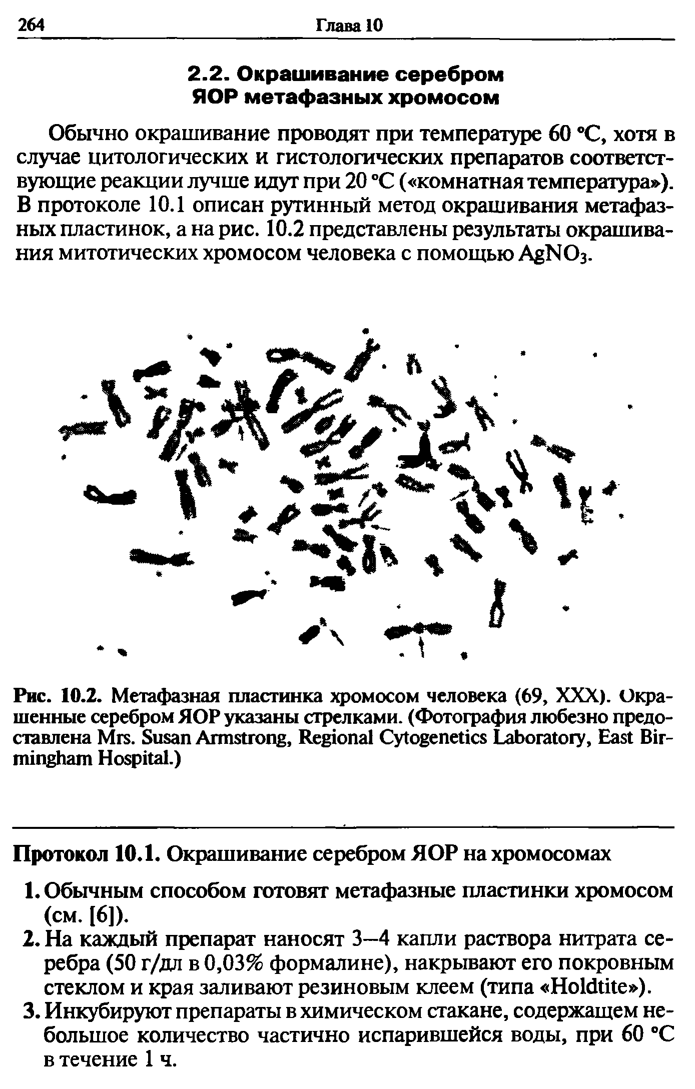 Рис. 10.2. Метафазная пластинка хромосом человека (69, XXX). Окрашенные серебром ЯОР указаны стрелками. (Фотография любезно предоставлена M . S A , R C L , E B H .)...