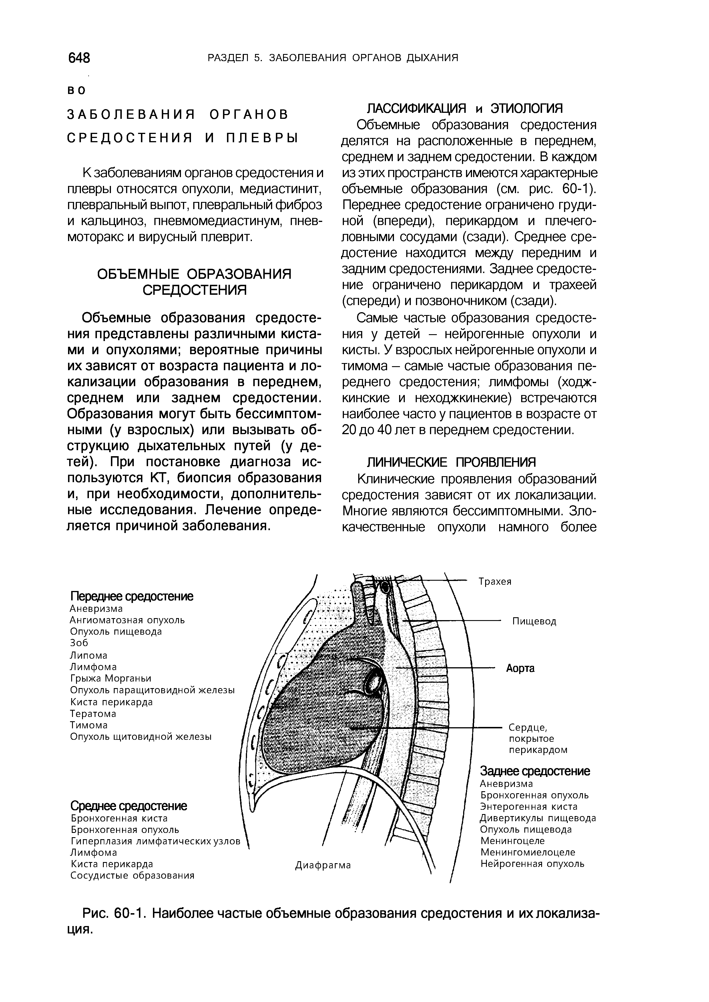 Рис. 60-1. Наиболее частые объемные образования средостения и их локализация.