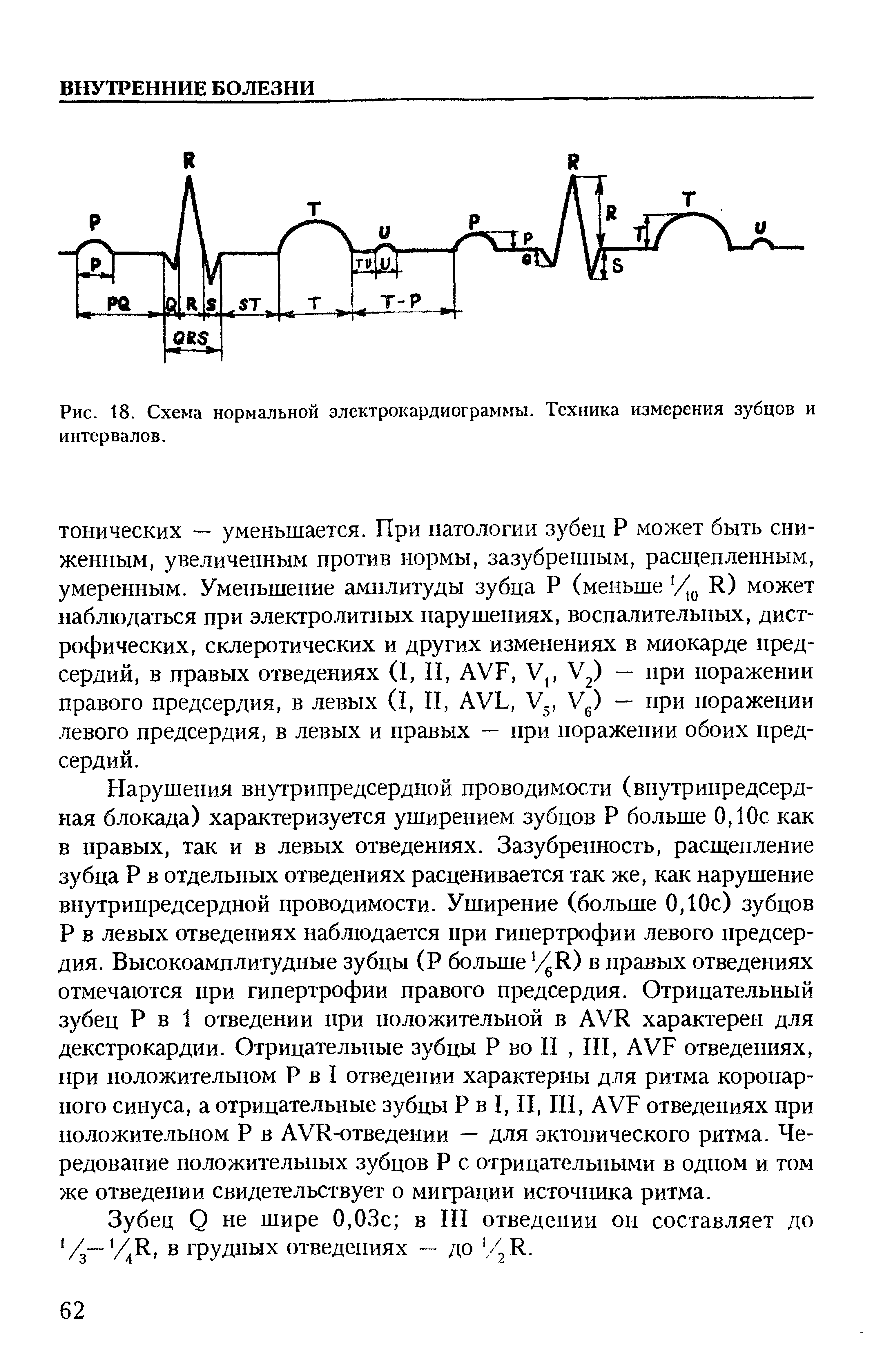 Рис. 18. Схема нормальной электрокардиограммы. Техника измерения зубцов и интервалов.