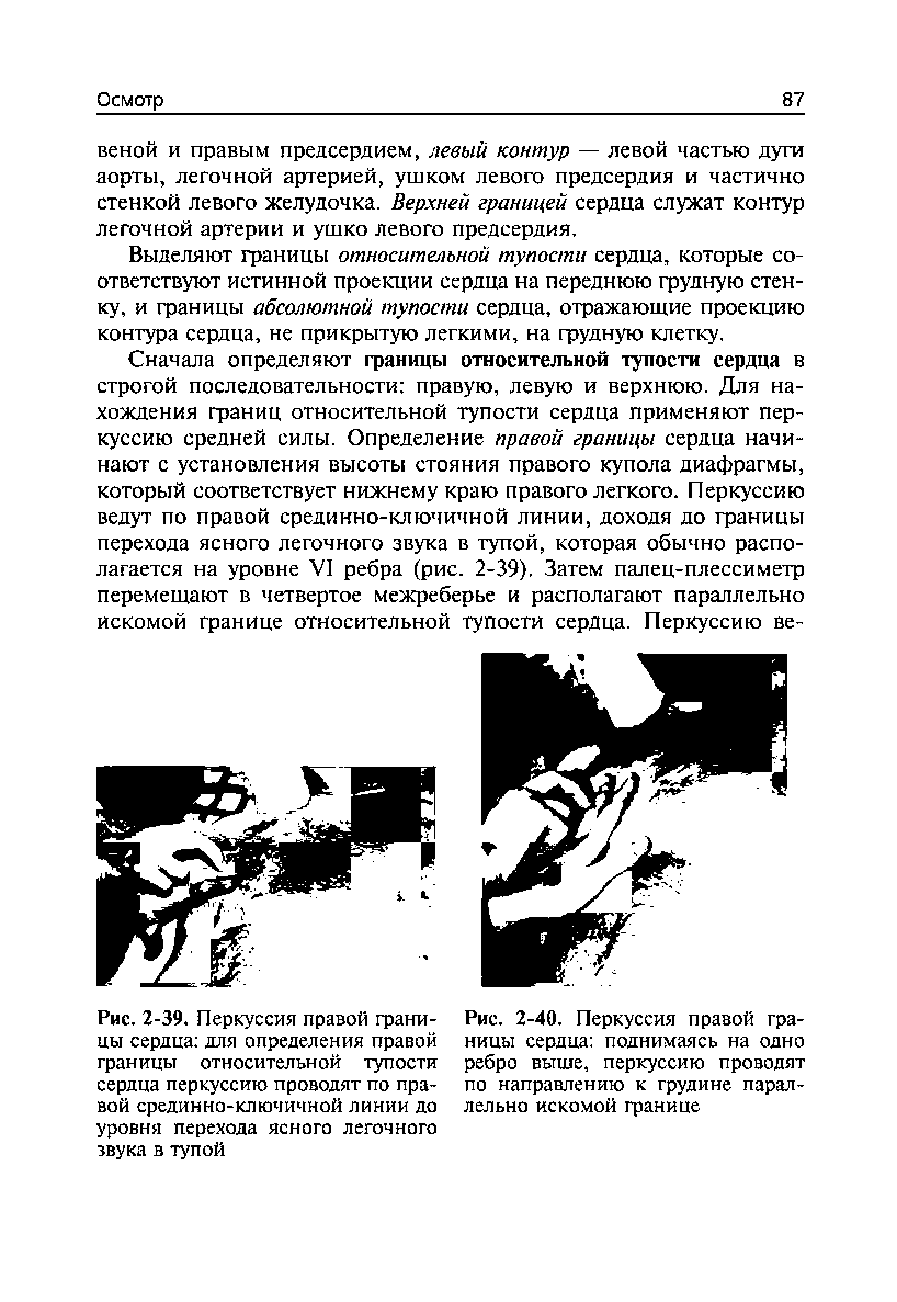 Рис. 2-40. Перкуссия правой границы сердца поднимаясь на одно ребро выше, перкуссию проводят по направлению к грудине параллельно искомой границе...