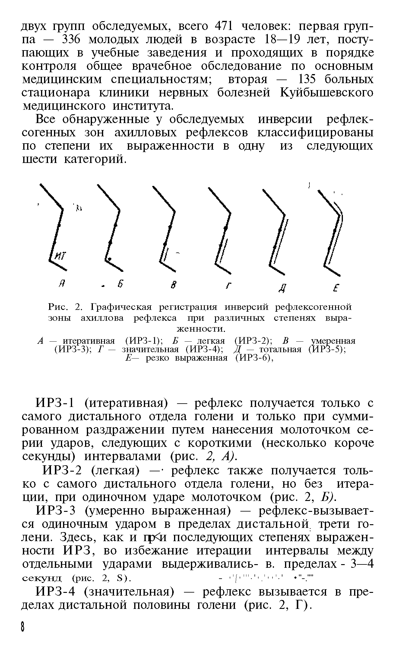 Рис. 2. Графическая регистрация инверсий рефлексогенной зоны ахиллова рефлекса при различных степенях выраженности.