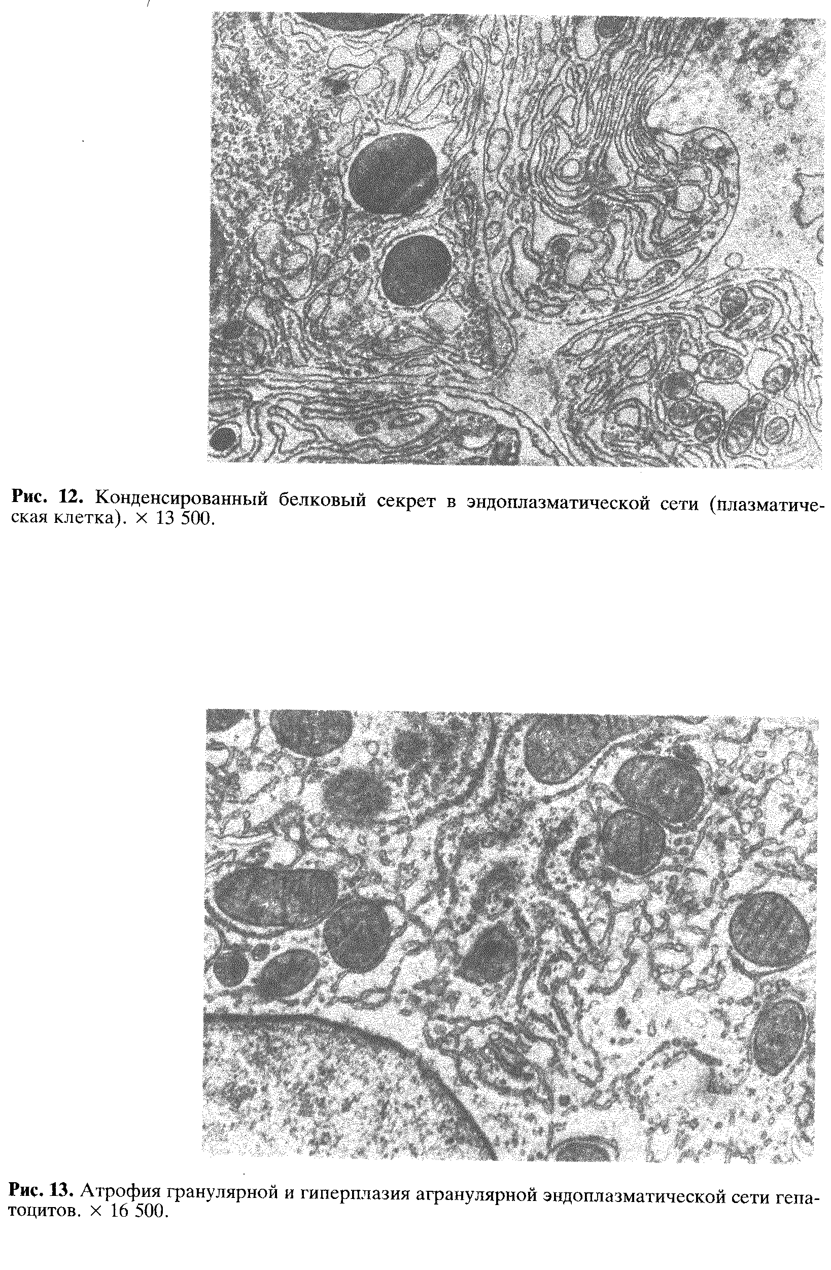 Рис. 13. Атрофия гранулярной и гиперплазия агранулярной эндоплазматической сети гепатоцитов. х 16 500.