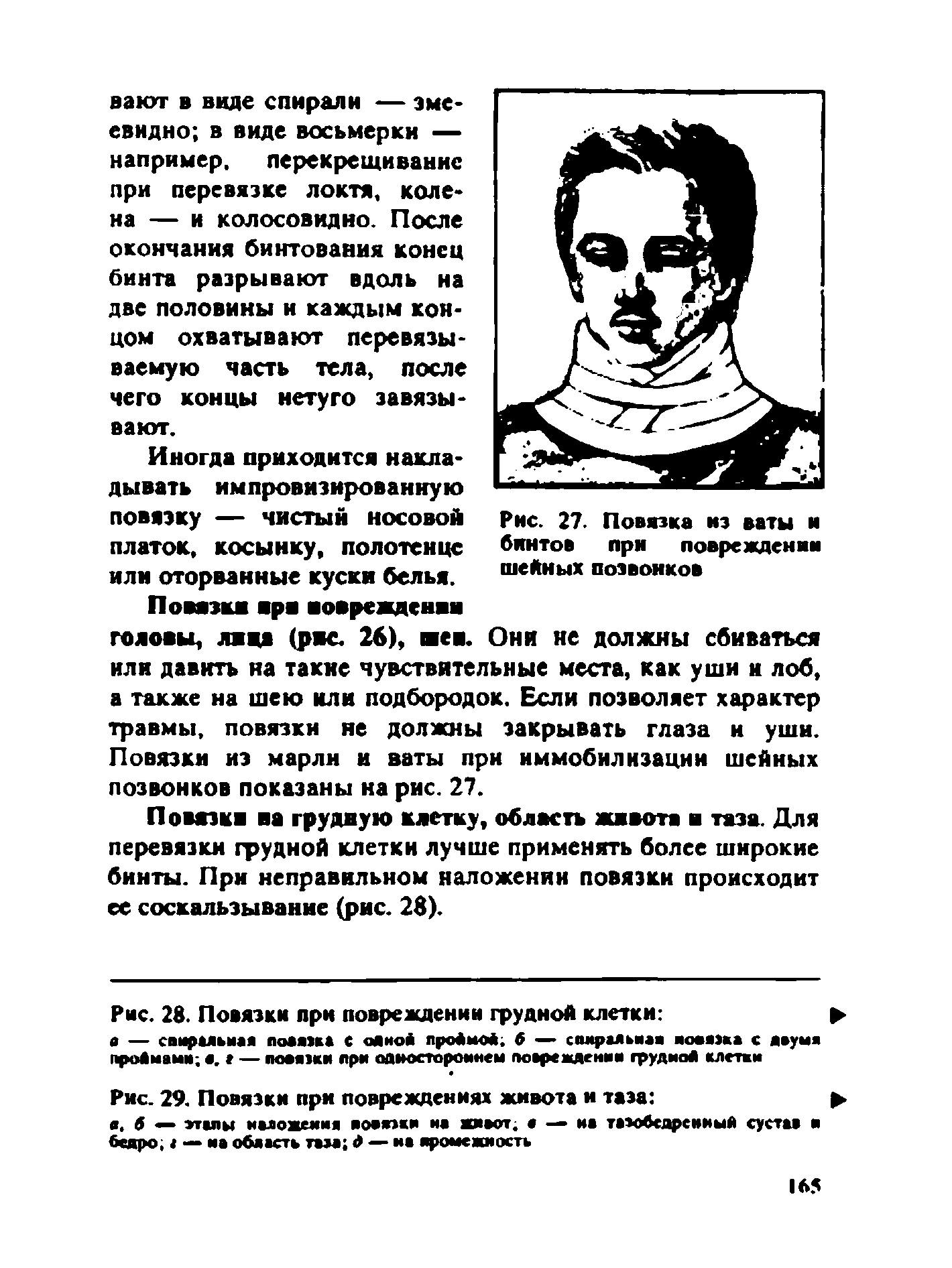 Рис. 27. Повязка из ваты и бинтов при повреждении шейных позвонков...