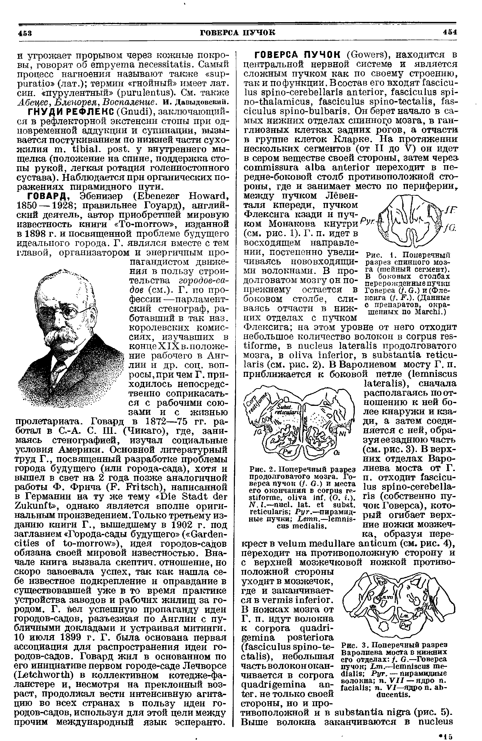 Рис. 3. Поперечный разрез Варолиева моста в нижних его отделах /. G.—Говерса пучок L .— Руг. — пирамидные волокна п. VII — ядро п. п. VI—ядро . - .