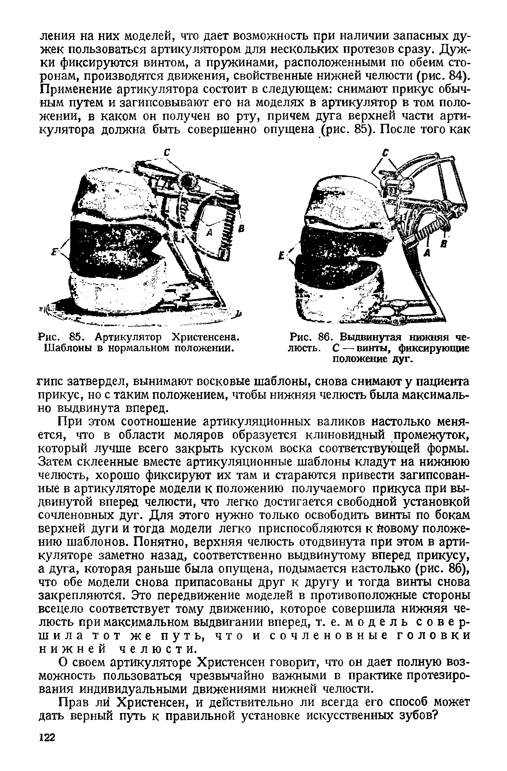 Рис. 86. Выдвинутая нижняя челюсть. С — винты, фиксирующие положение дуг.