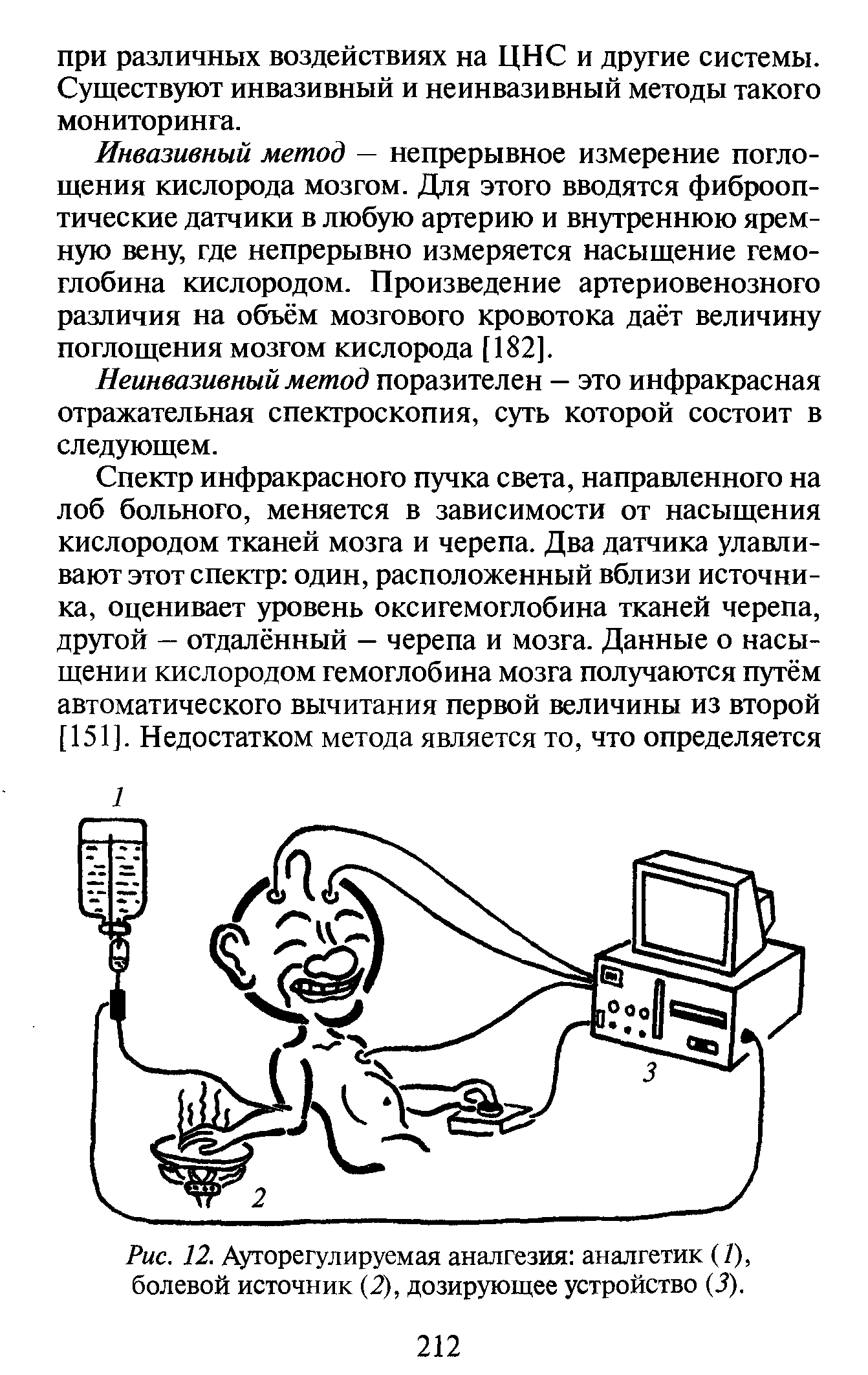 Рис. 12. Ауторегулируемая аналгезия аналгетик (/), болевой источник (2), дозирующее устройство (3).