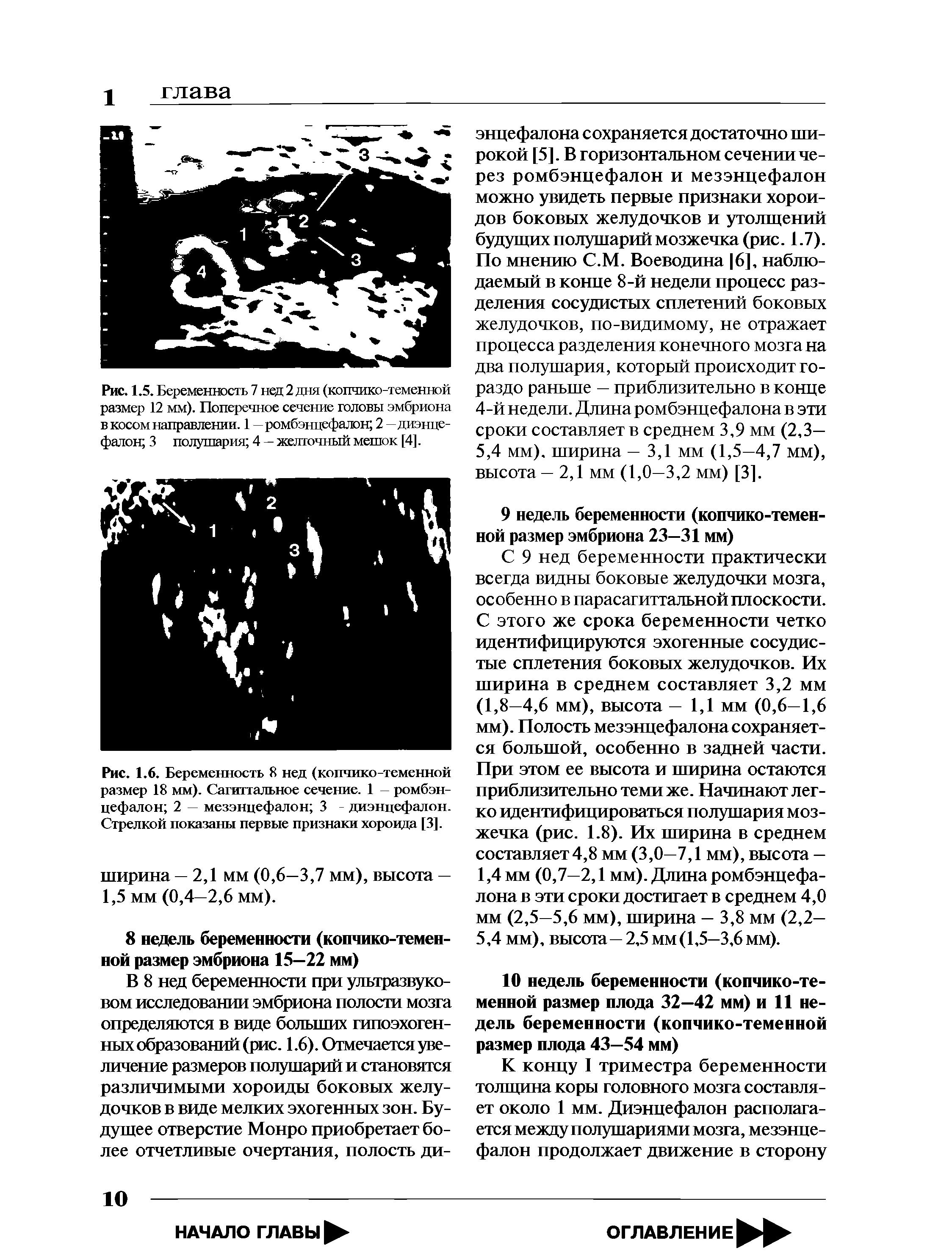 Рис. 1.5. Беременность 7 нед 2 дня (копчико-теменной размер 12 мм). Поперечное сечение головы эмбриона в косом направлении. 1 — ромбэнцефалон 2 — диэнцефалон 3 полушария 4 — желточный мешок [4].