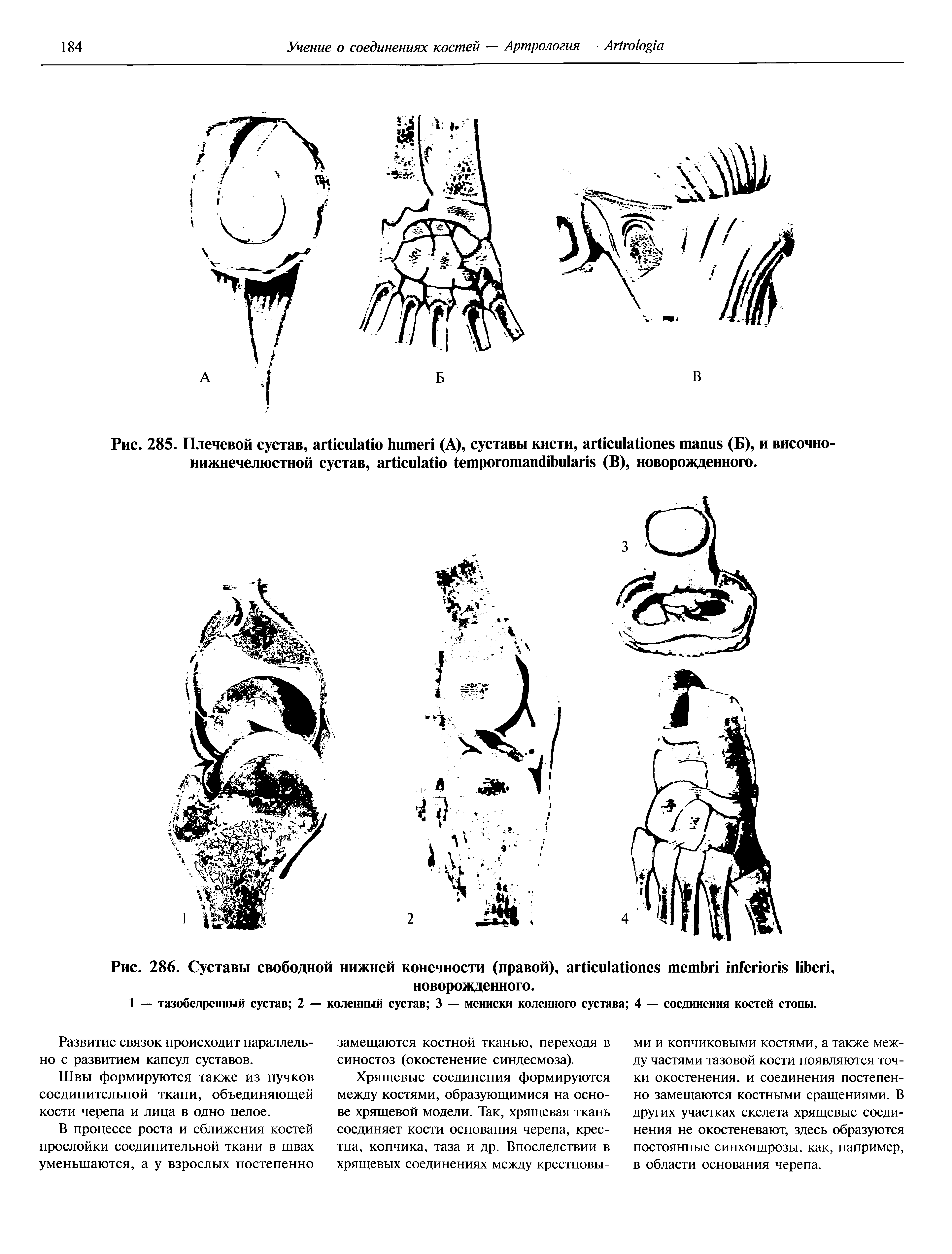 Рис. 285. Плечевой сустав, (А), суставы кисти, (Б), и височно-нижнечелюстной сустав, (В), новорожденного.