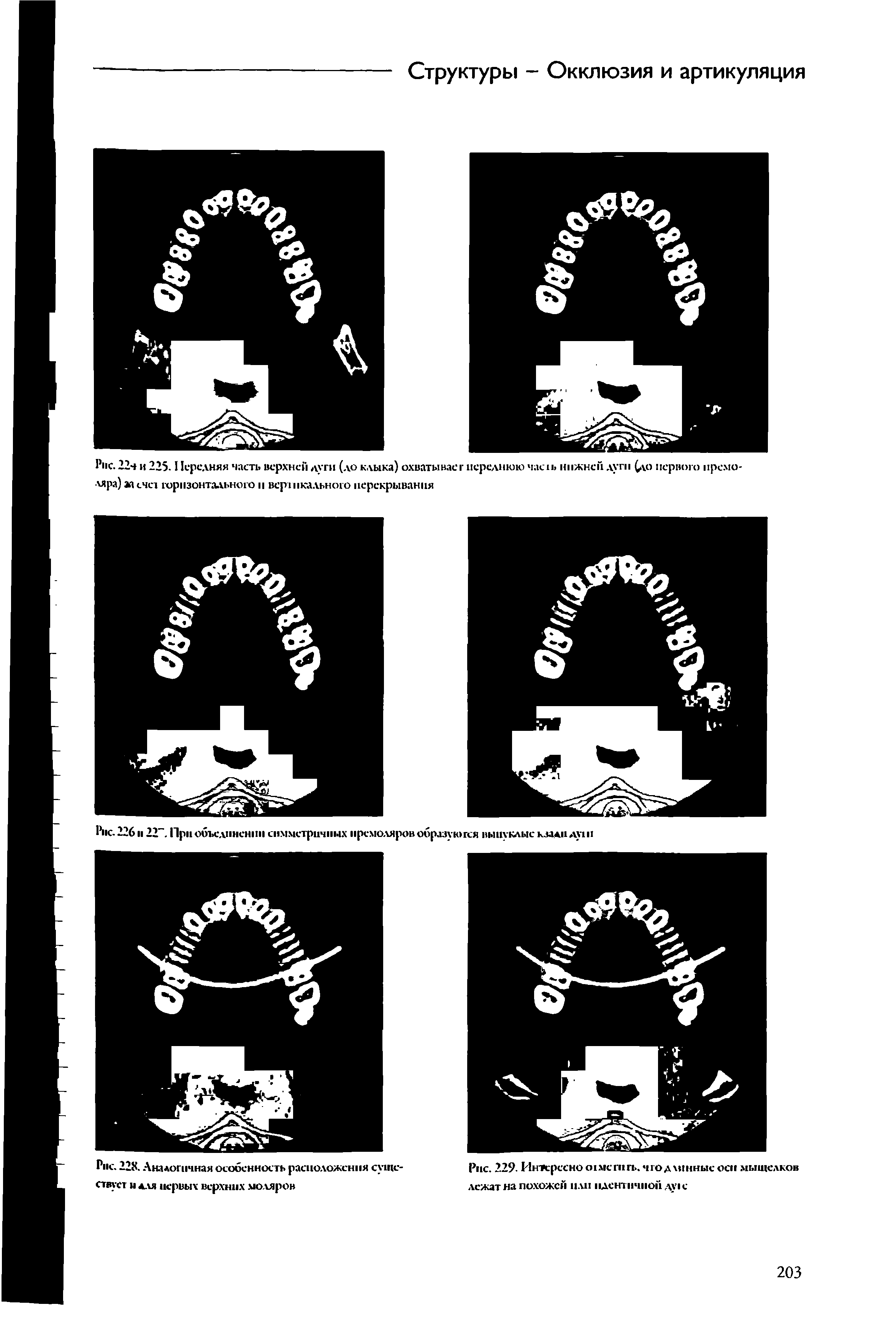 Рис. 228. Аналогичная особенность расположения существует н для первых верхних моляров...