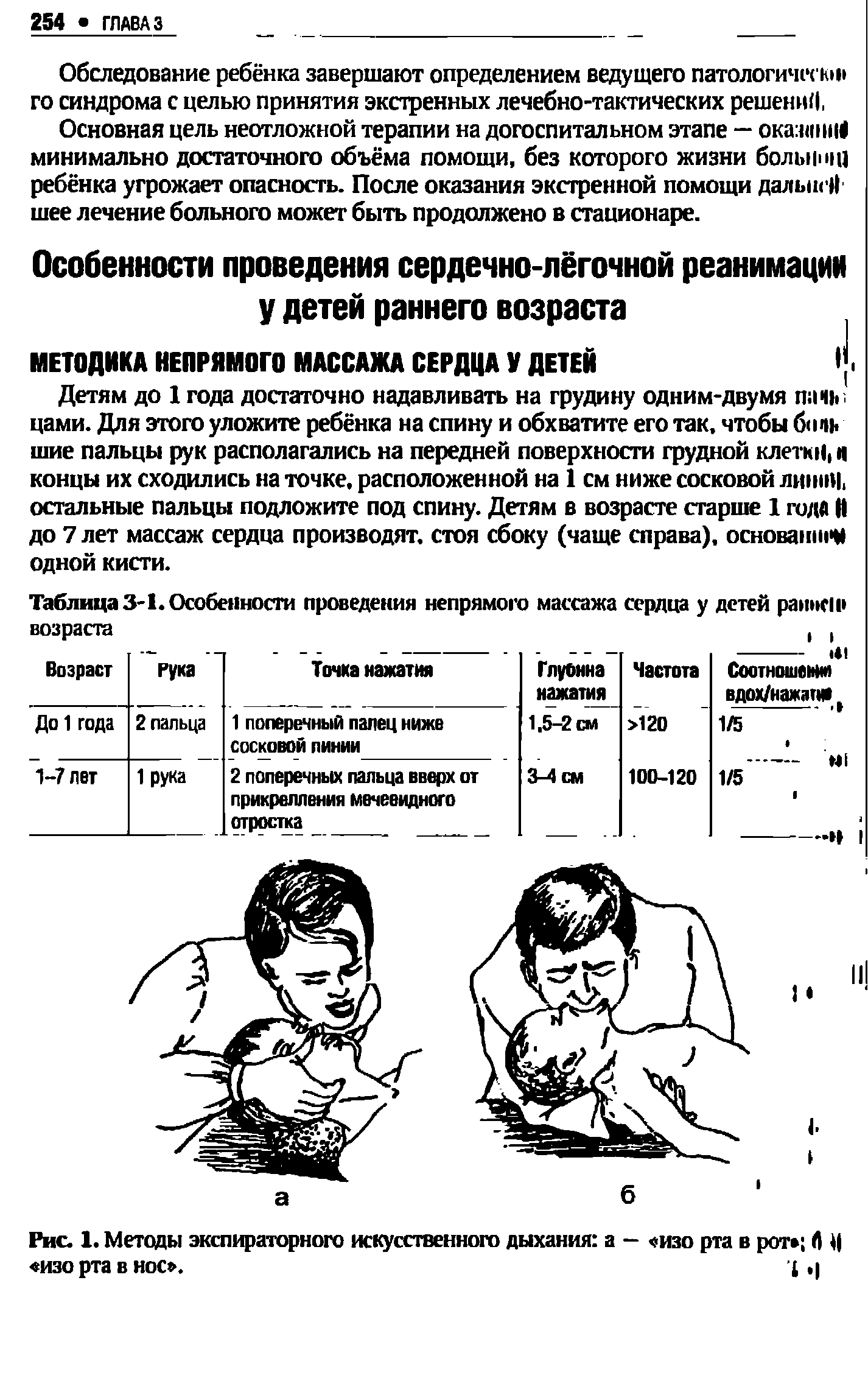Таблица 3-1. Особенности проведения непрямого массажа сердца у детей ранне и...