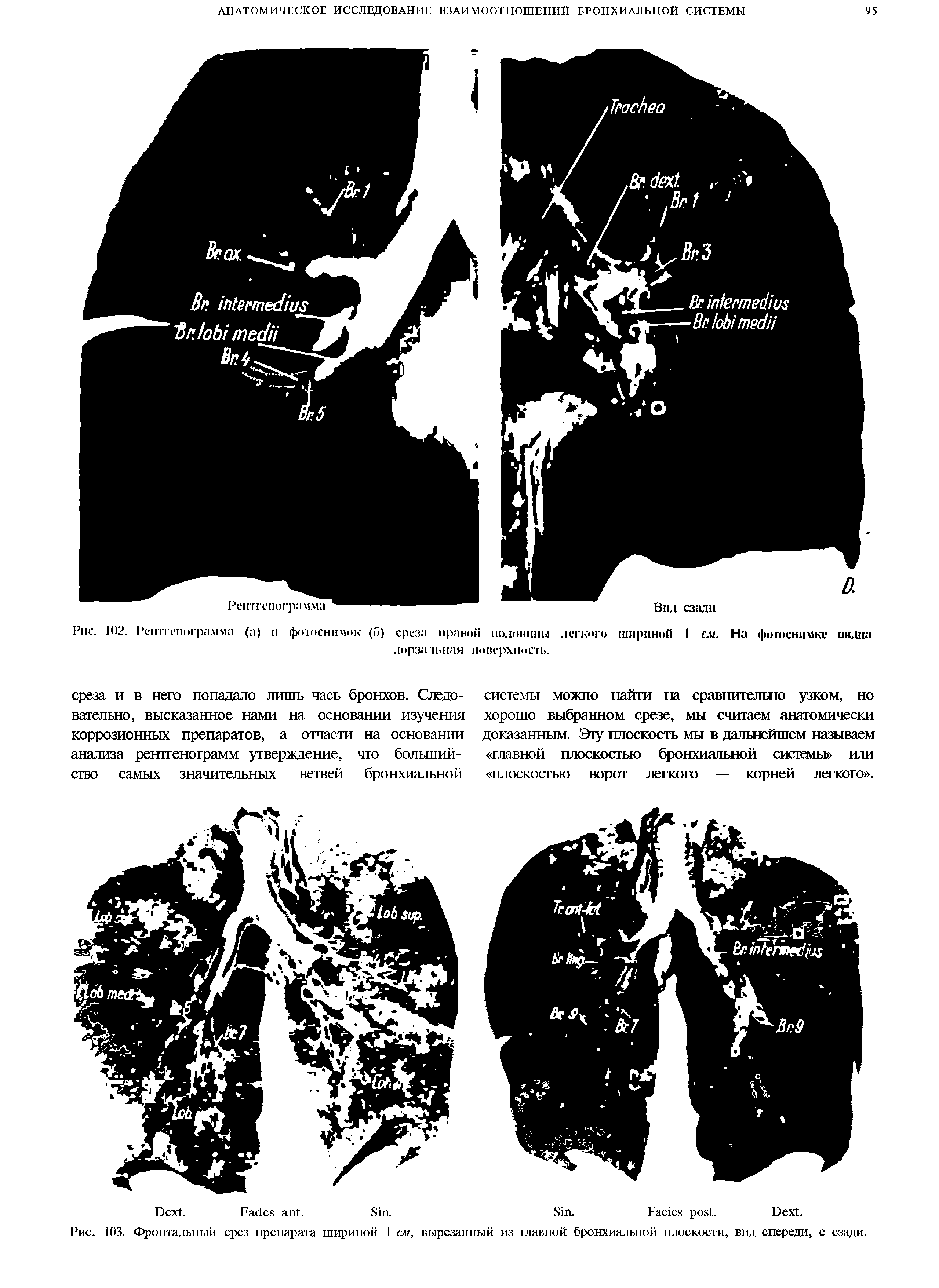 Рис. 103. Фронтальный срез препарата шириной 1 см, вырезанный из главной бронхиальной плоскости, вид спереди, с сзади.