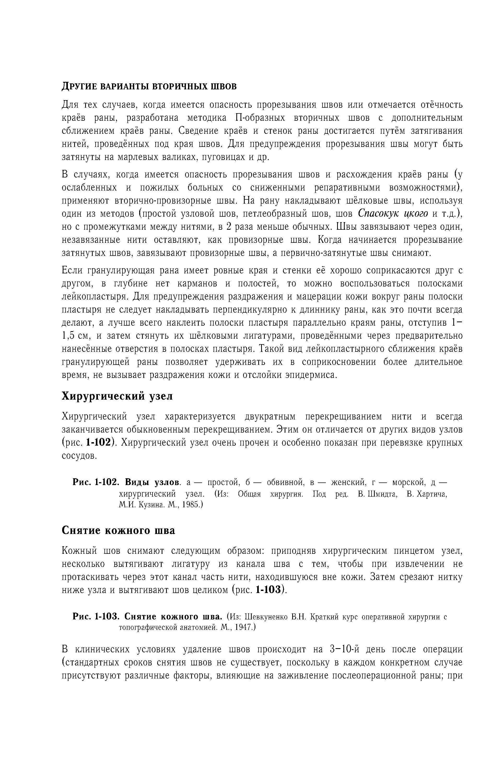 Рис. 1-102. Виды узлов, а — простой, б — обвивной, в — женский, г — морской, д — хирургический узел. (Из Общая хирургия. Под ред. В. Шмидта, В. Хартича, М.И. Кузина. М., 1985.)...