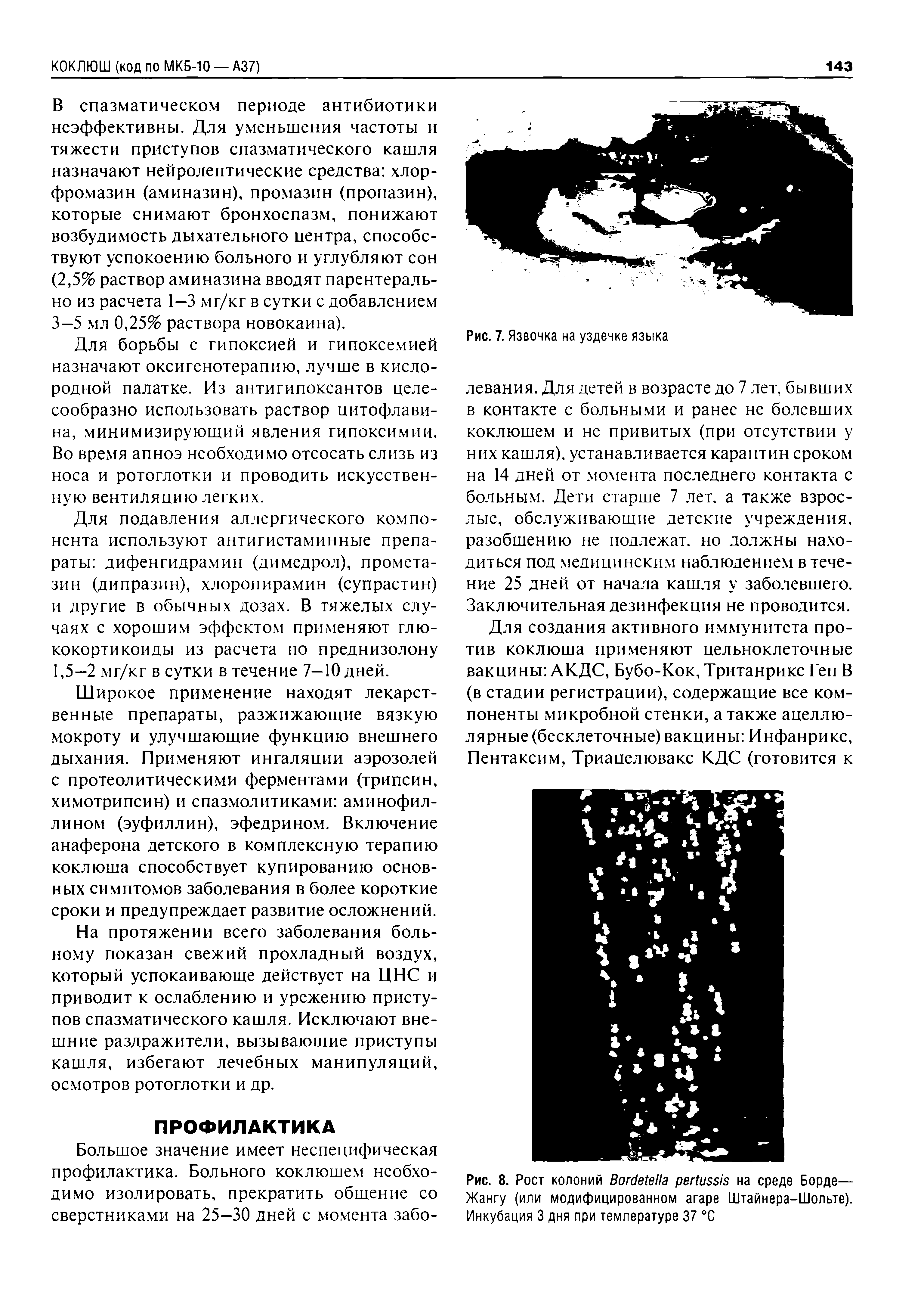 Рис. 8. Рост колоний B на среде Борде— Жангу (или модифицированном агаре Штайнера-Шольте). Инкубация 3 дня при температуре 37 °C...