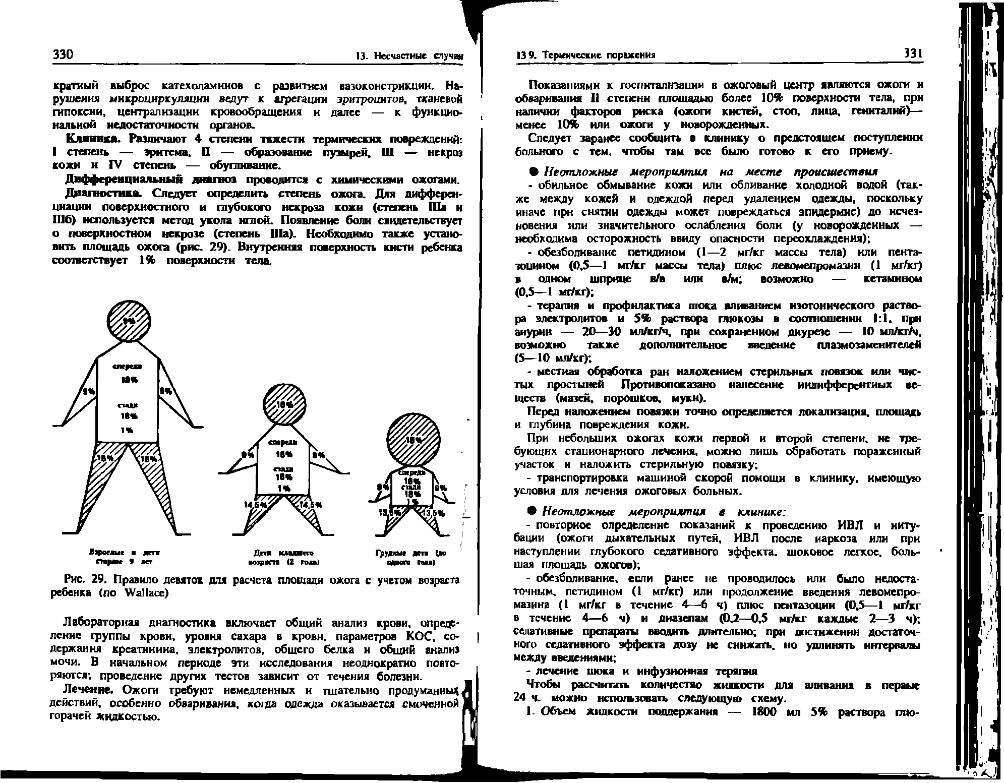 Рис. 29. Правило девяток для расчета площади ожога с учетом возраста ребенка (по W )...