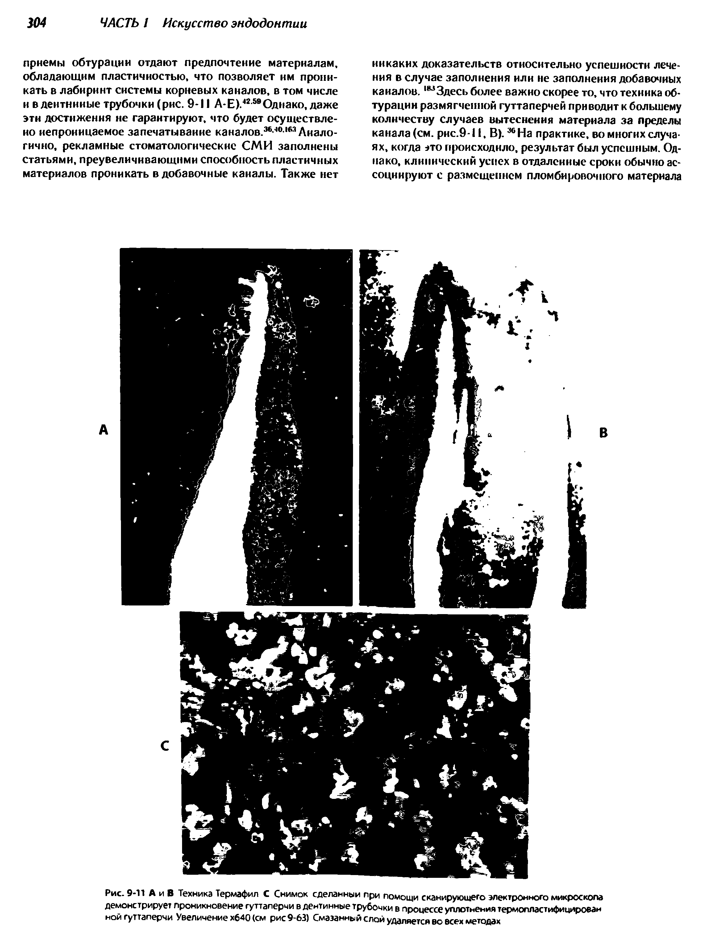 Рис. 9-11 А и В Техника Термафил С Снимок сделанный при помощи сканирующего электронного микроскопа демонстрирует проникновение гуттаперчи в дентинные трубочки в процессе уплотнения термопластифицироваи ной гуттаперчи Увеличение х640 (см рис 9-63) Смазанный слой удаляется во всех методах...