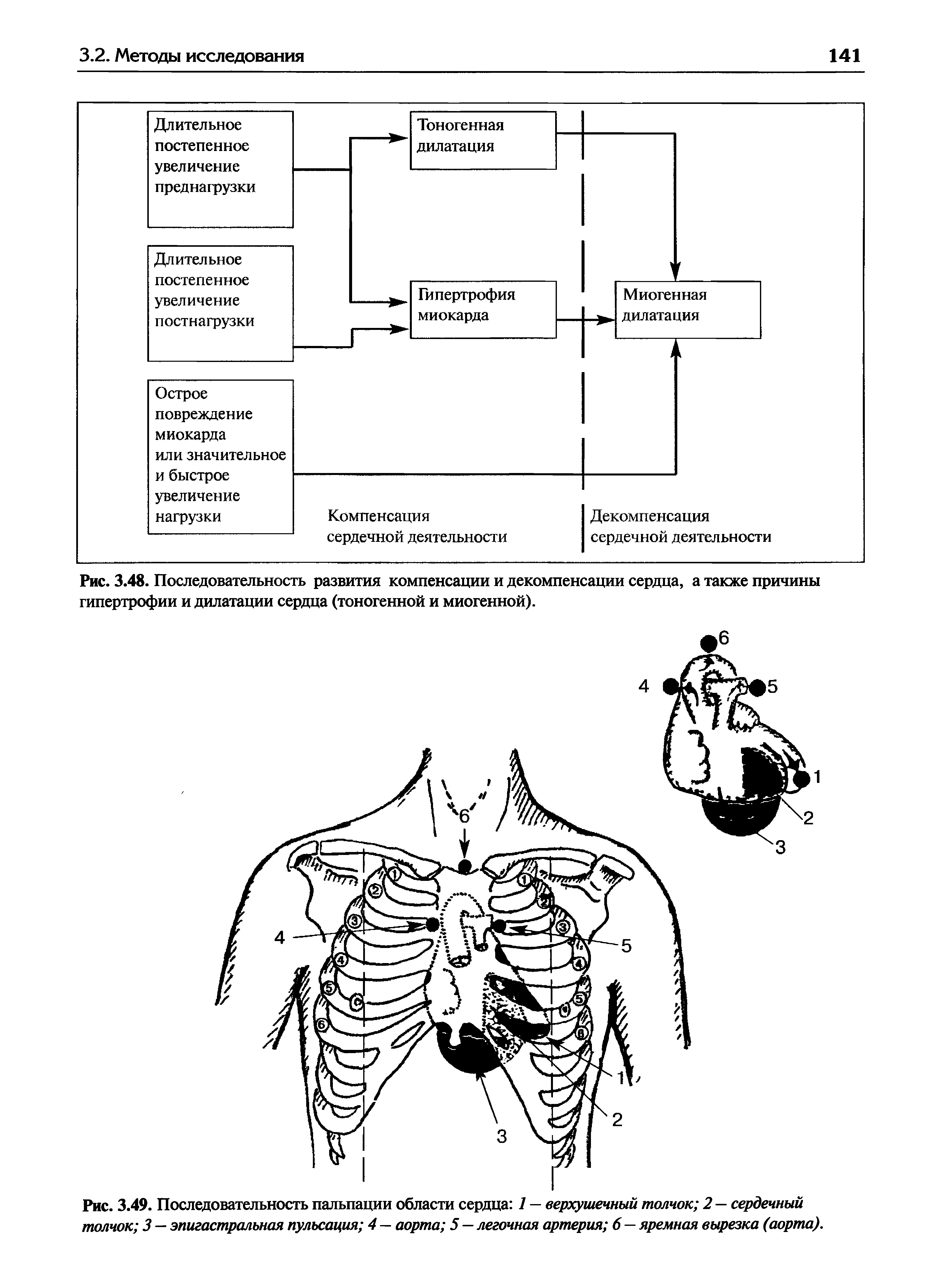 Рис. 3.49. Последовательность пальпации области сердца 1 — верхушечный толчок 2 — сердечный толчок 3 — эпигастральная пульсация 4 — аорта 5 — легочная артерия 6—яремная вырезка (аорта).