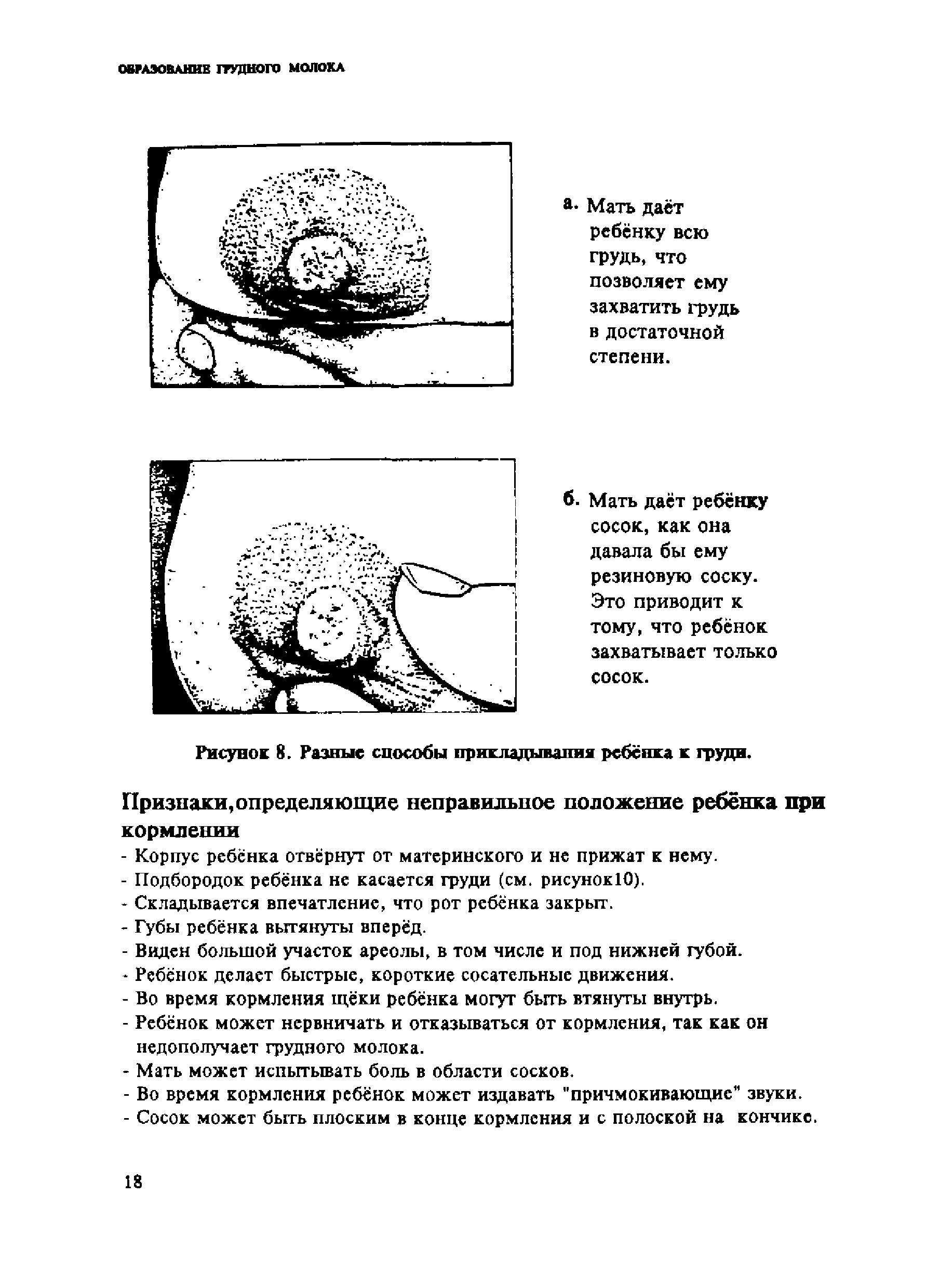 Рисунок 8. Разные способы прикладывания ребёнка к груди. Признаки, определяющие неправильное положение ребёнка при кормлении...