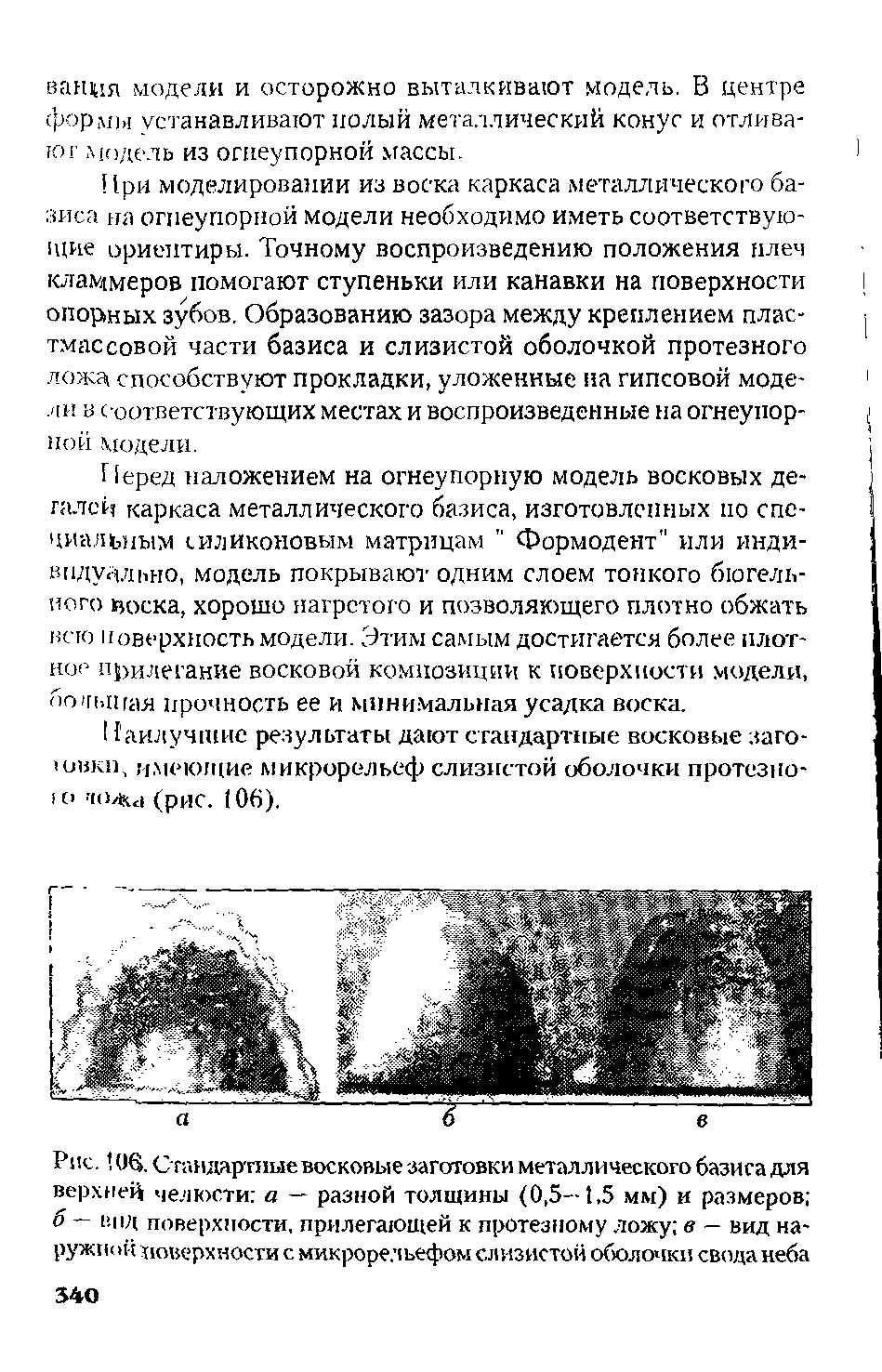 Рис. 10в. Стандартные восковые -заготовки металлического базиса для верхней челюсти а — разной толщины (0,5—1.5 мм) и размеров б — вид поверхности, прилегающей к протезному ложу в — вид наружной поверхности с микрорельефом слизистой обюлочки свода неба...