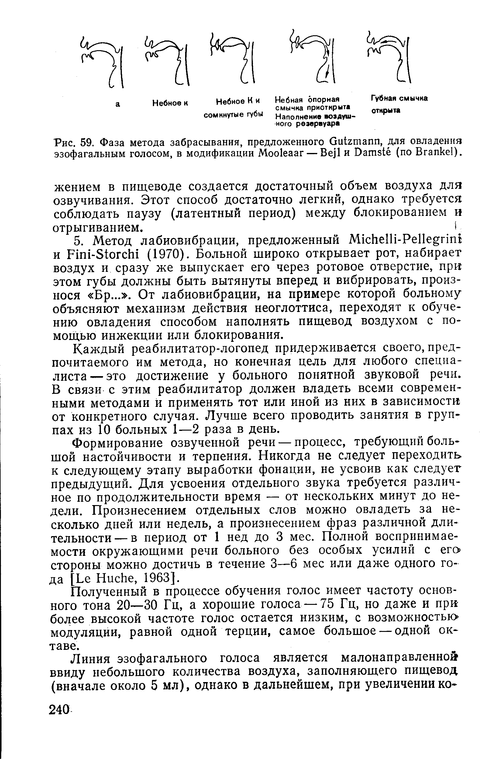 Рис. 59. Фаза метода забрасывания, предложенного й гтапп, для овладения эзофагальным голосом, в модификации Моо1еааг — B . и Оатв (по Вгапке ).