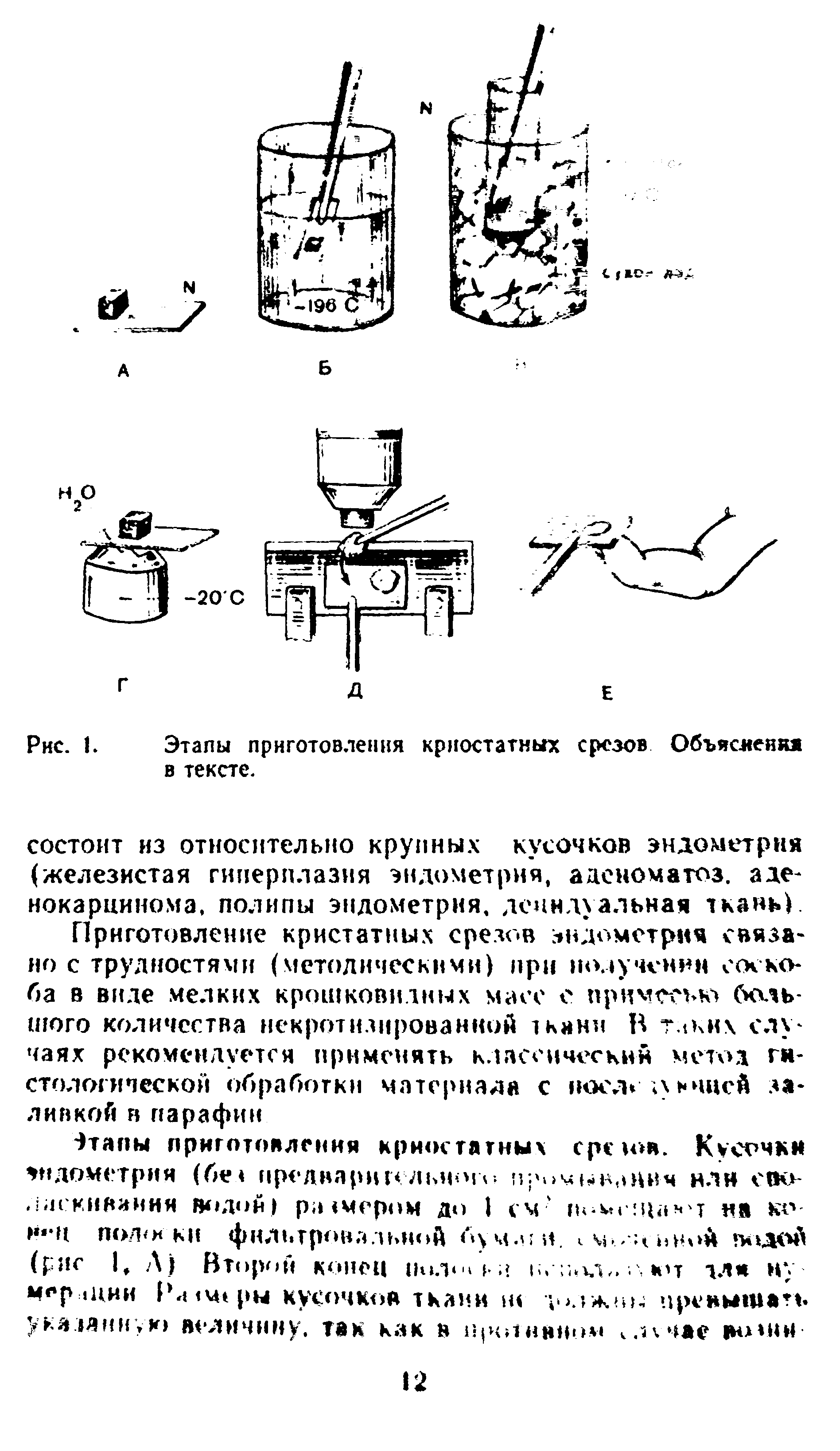 Рис. 1. Этапы приготовления криостатных срезов Объяскеняя в тексте.