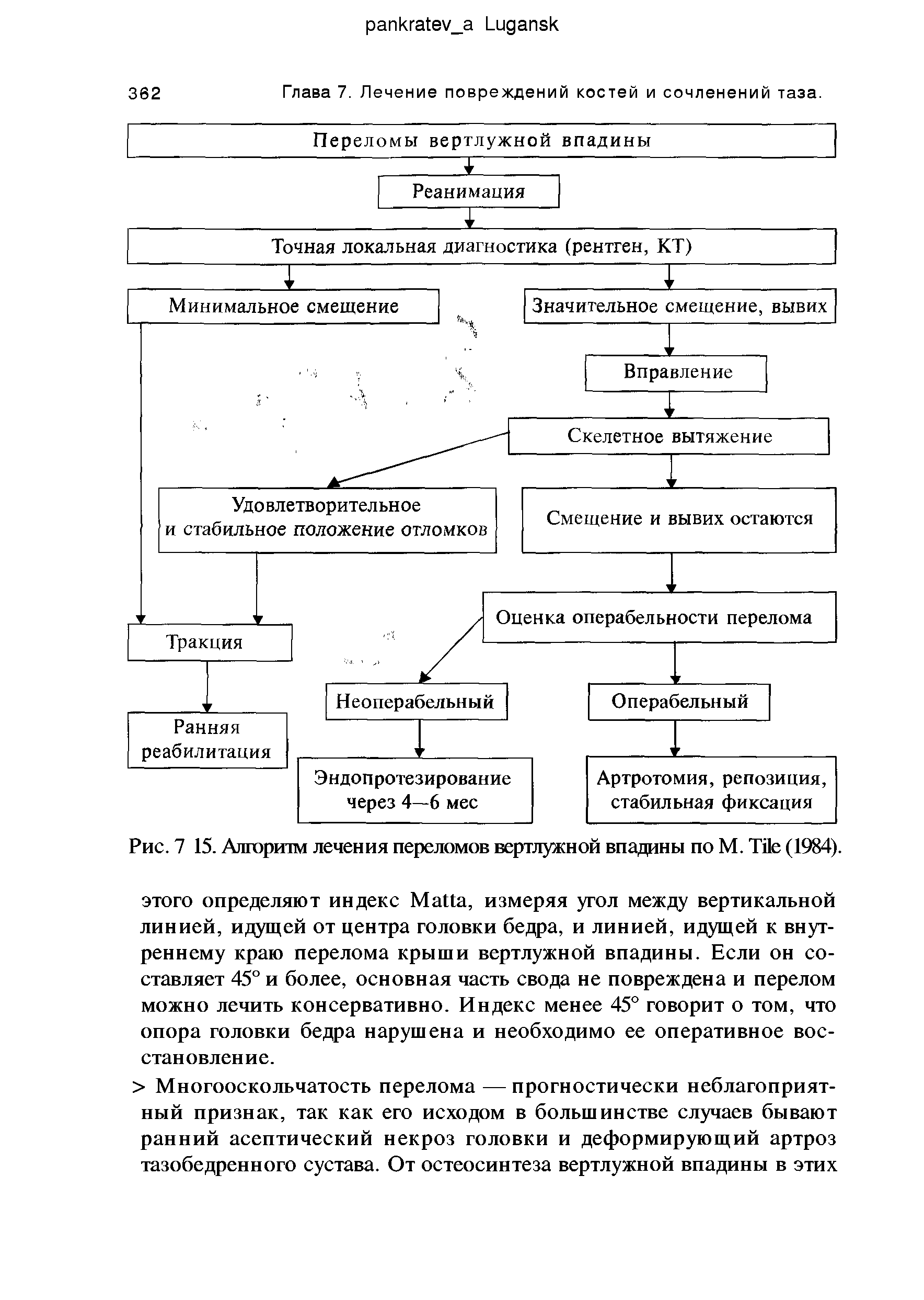 Рис. 7 15. Алгоритм лечения переломов вертлужной впадины по М. T (1984).