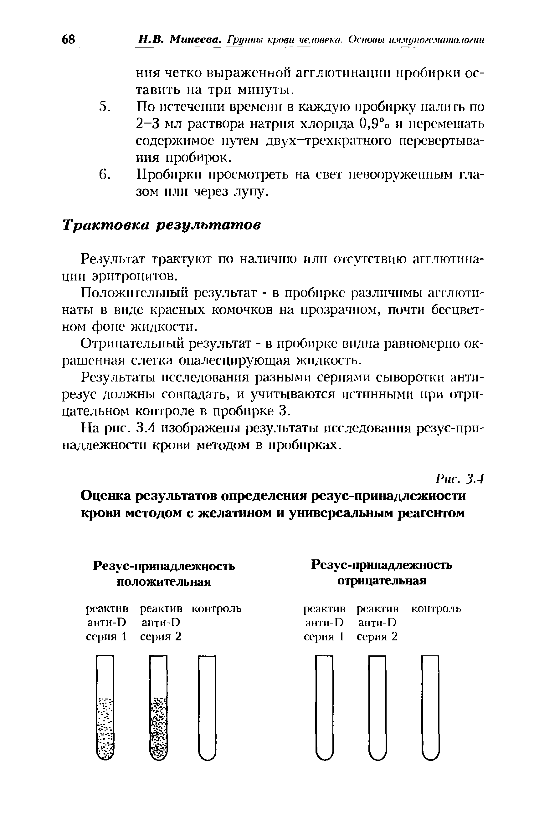 Рис. 3.4 Оценка результатов определения резус-принадлежности крови методом с желатином и универсальным реагентом...