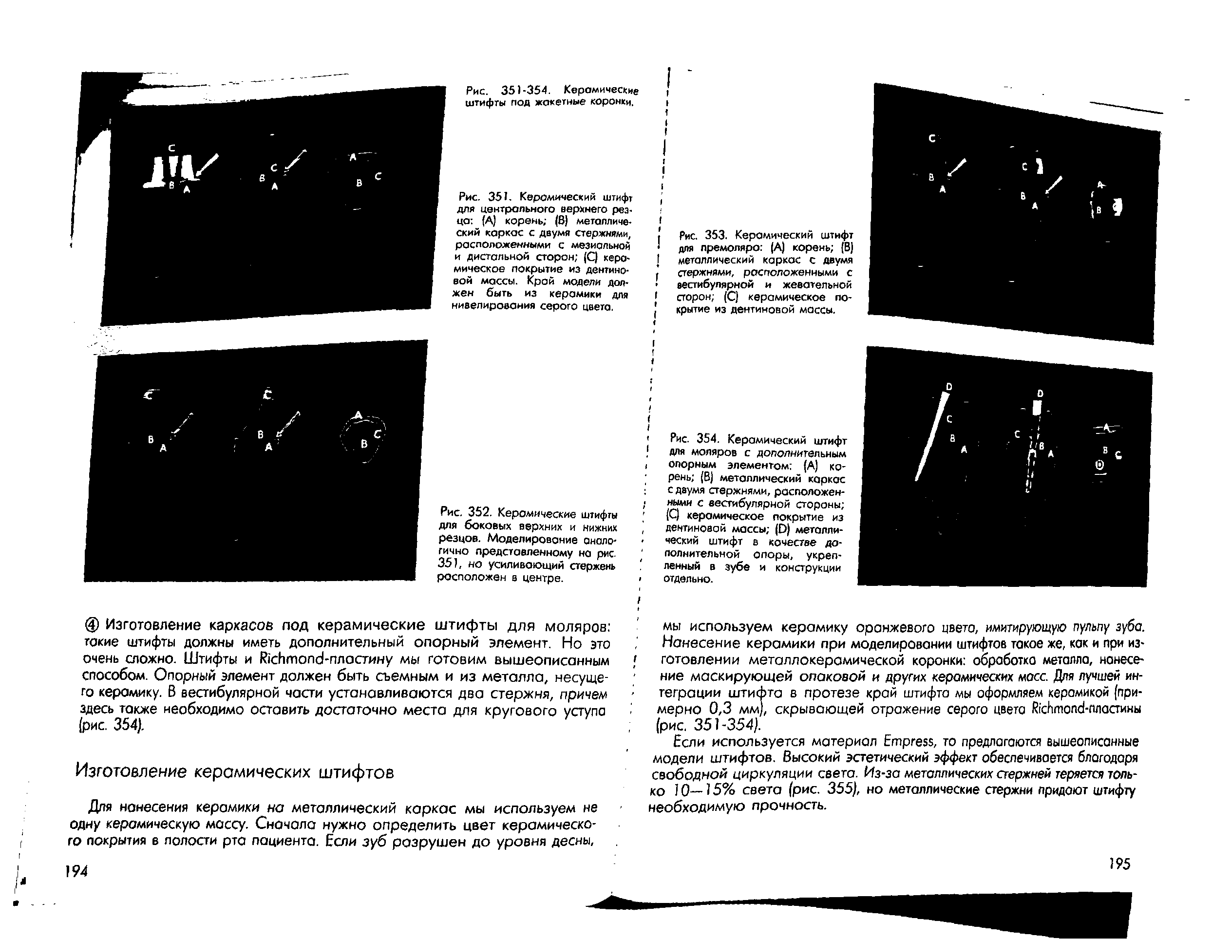 Рис. 354. Керамический штифт для моляров с дополнительным опорным элементом (А) корень (В) металлический каркас с двумя стержнями, расположенными с вестибулярной стороны (С) керамическое покрытие из дентиновой массы ( )) металлический штифт в качестве дополнительной опоры, укрепленный в зубе и конструкции отдельно.