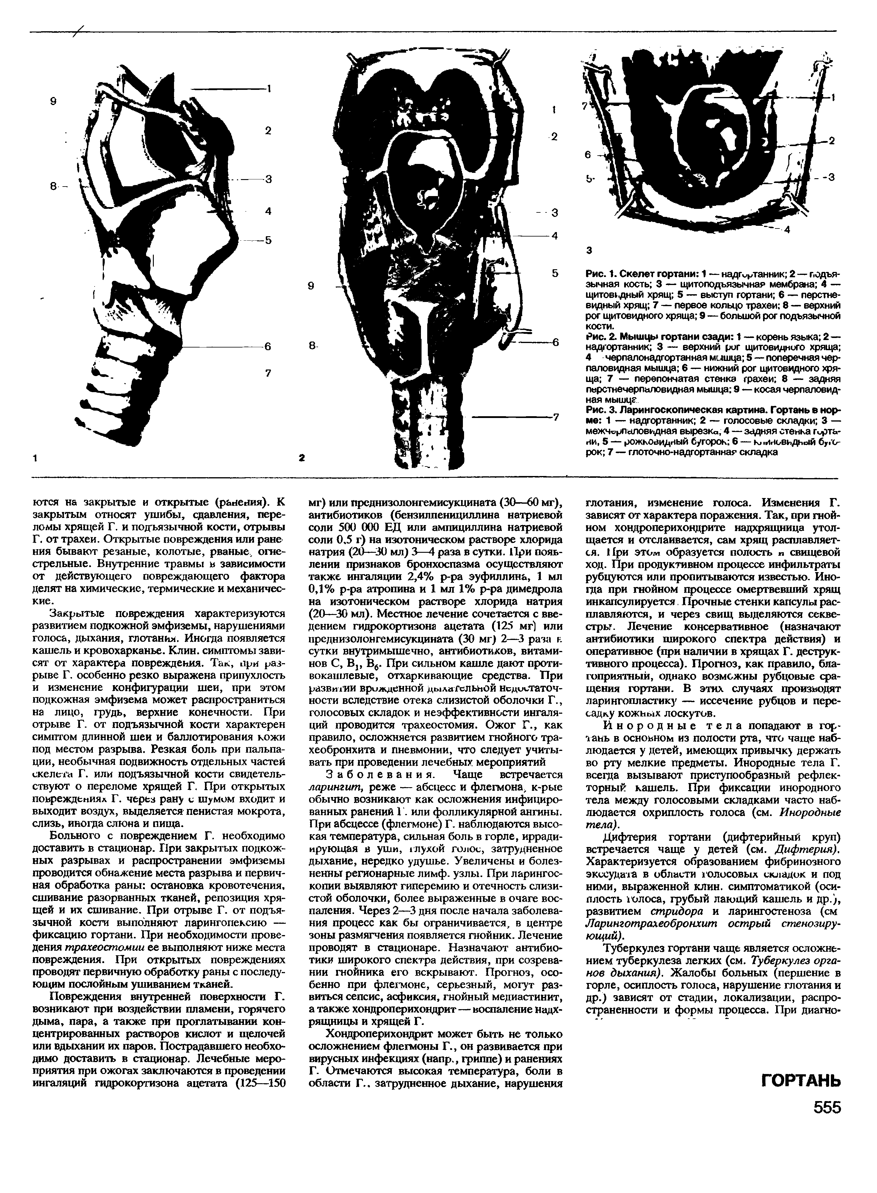 Рис. 3. Ларингоскопическая картина. Гортань в норме 1 — надгортанник 2 — голосовые складки 3 — межчорпаловидная вырезк , 4 — задняя стенка Гортани, 5 — рожковидный бугорок 6 — клиновидный бугорок 7 — глоточно-надгортанная складка...