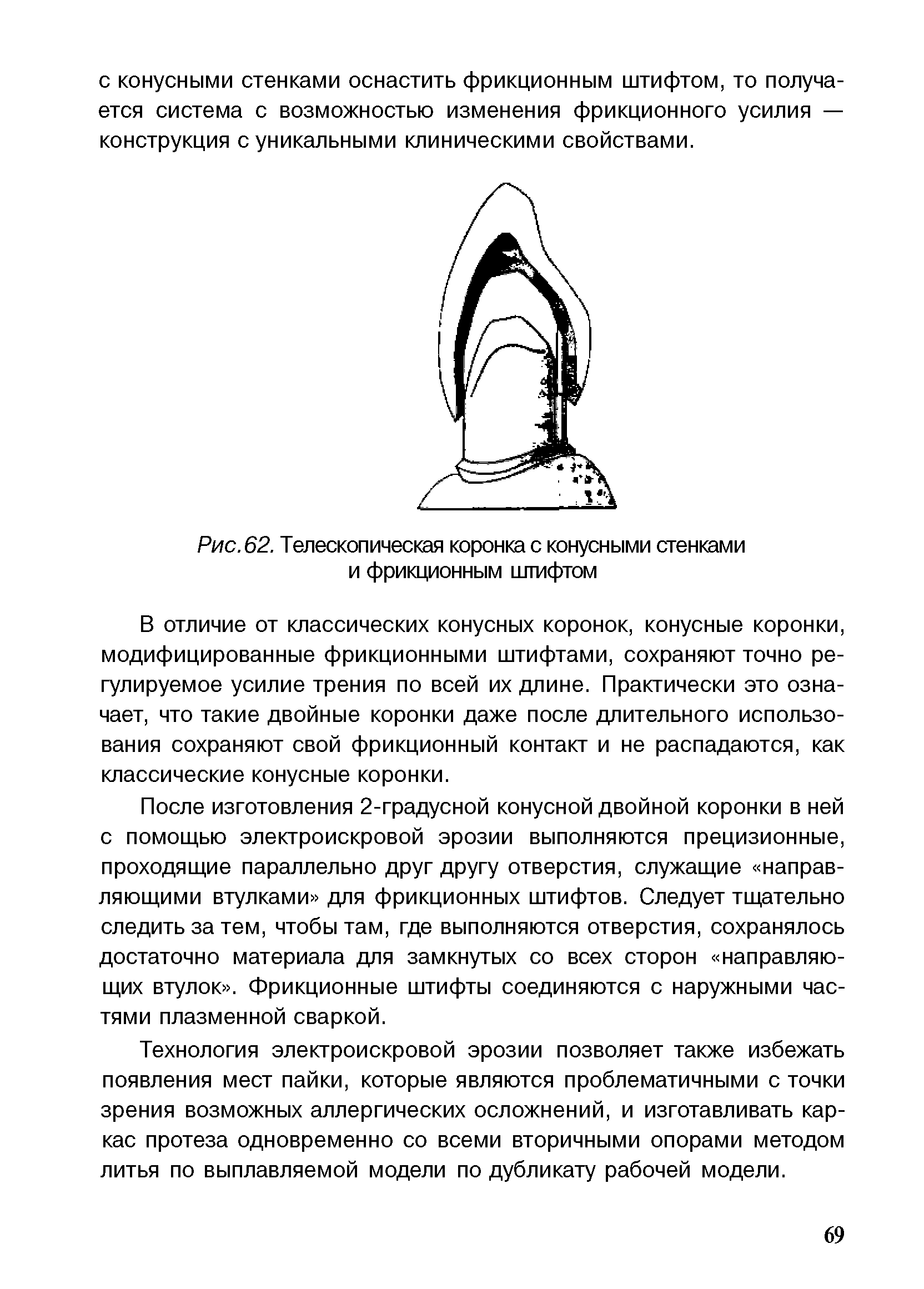 Рис. 62. Телескопическая коронка с конусными стенками и фрикционным штифтом...