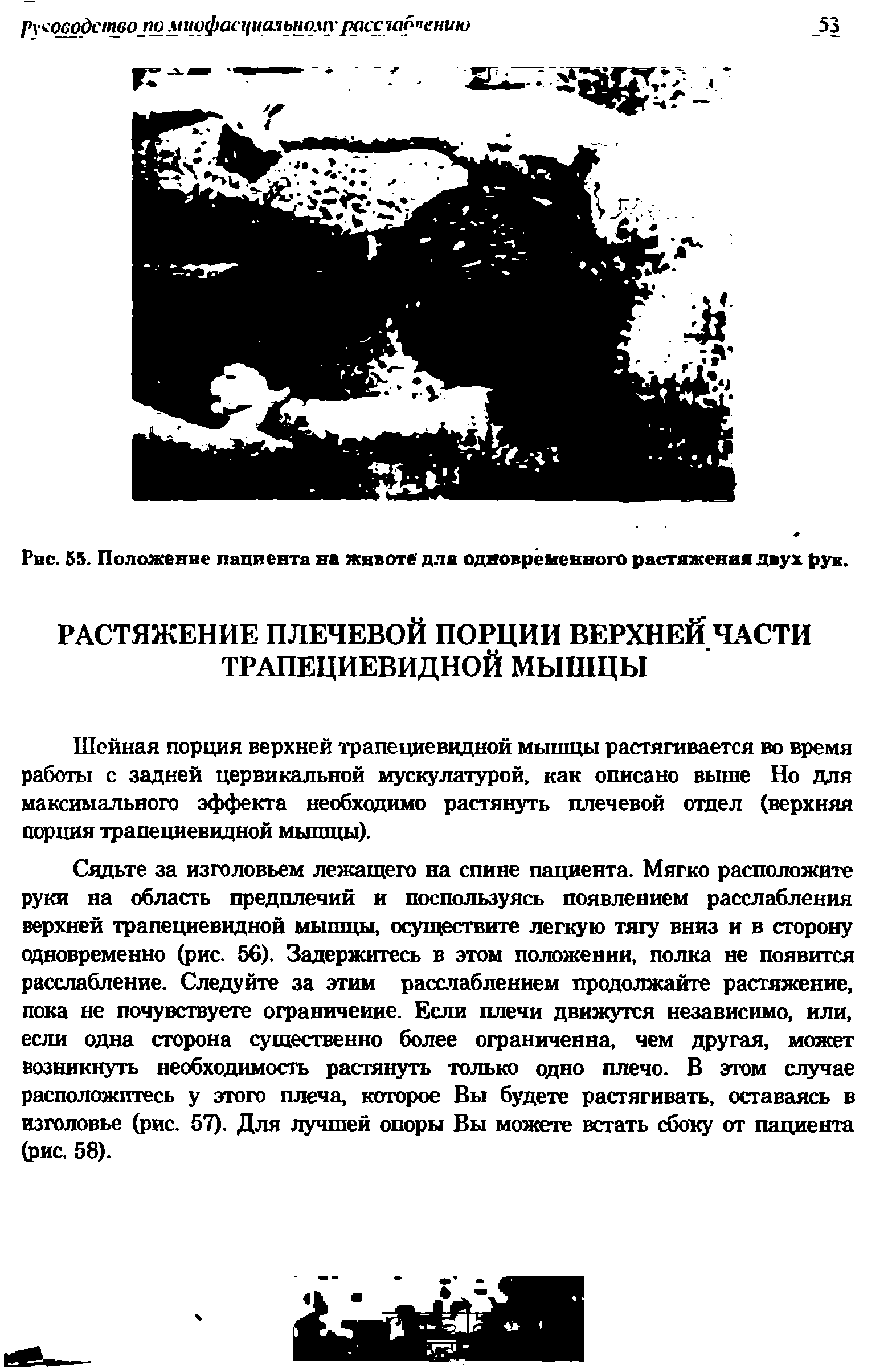 Рис. 65. Положение пациента на животе для одновременного растяжения двух рук.